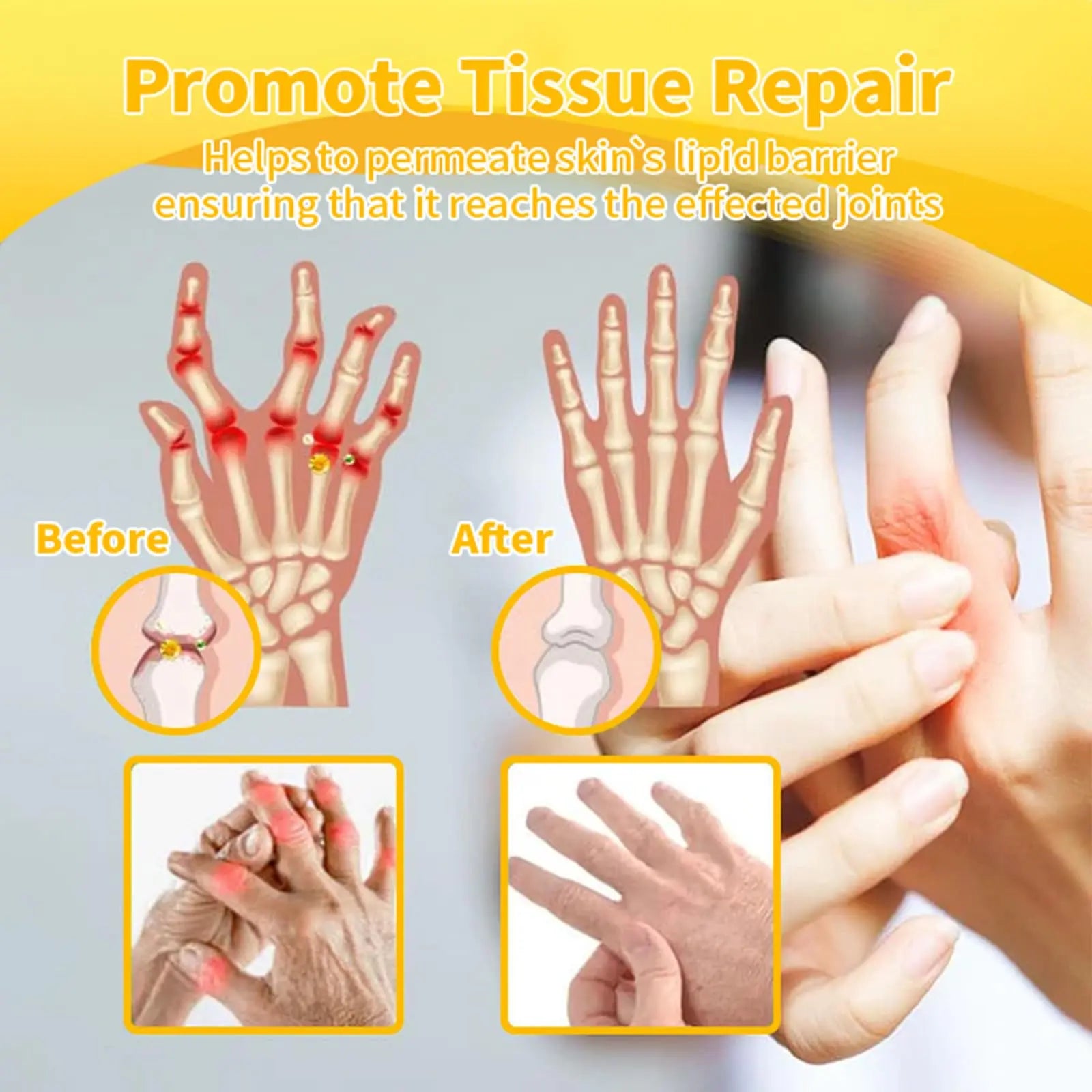 Luhaka Botulinum Toxin & Bee Venom Pain-Relief Bone Healing Cream,Bee Venom Cream,Effectively improve joint mobility (1PC) Luhaka uk supplements