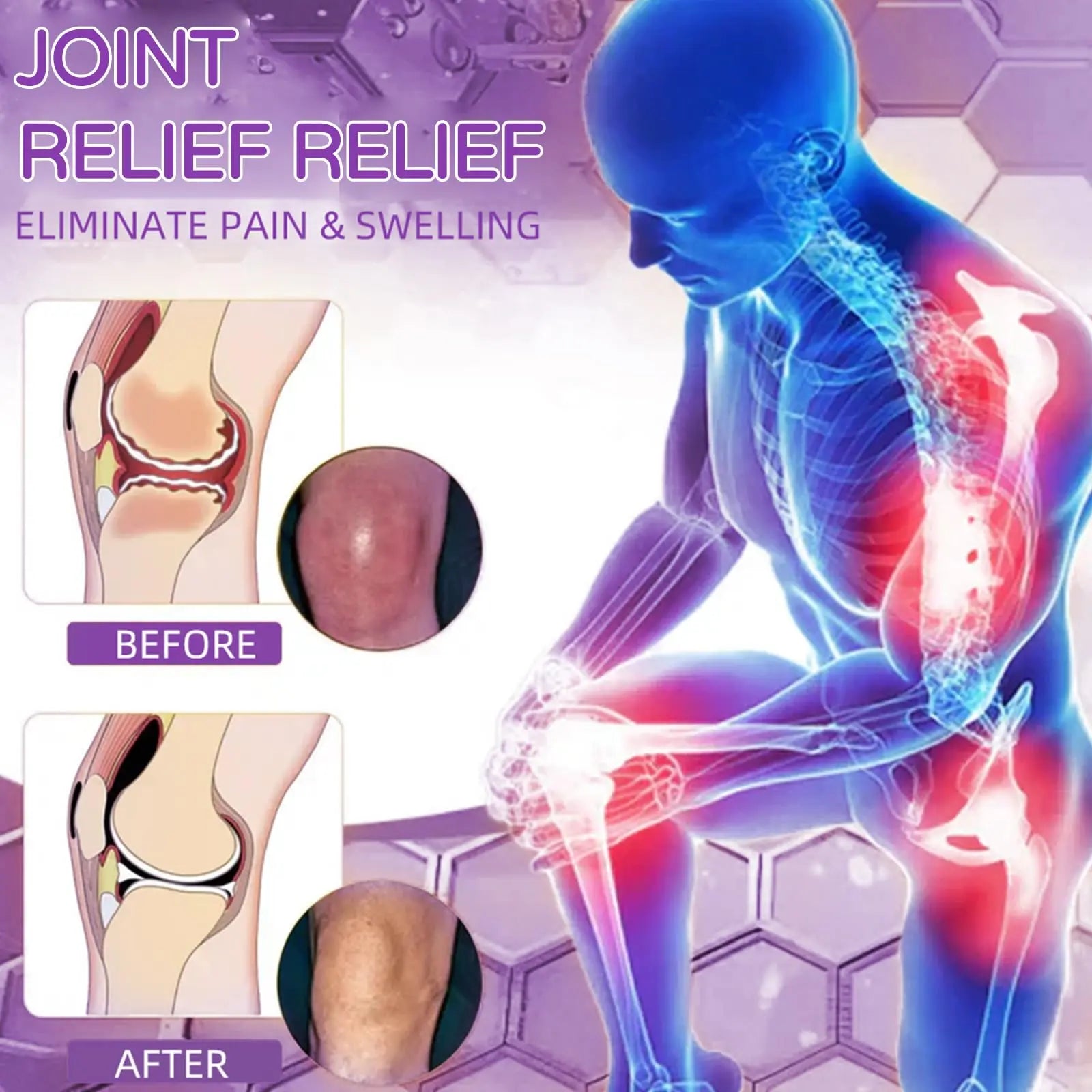 Flexbalm Rapid Joint Relief Therapy Gel 2.0, 2026 New Professional Relief Soothing Massage Gel, Flexbalm Rapid Joint Relief Cream for Back, Knee, Hands, Neck, Feet, for All Skin Types (2 Bottle) dooeka uk supplements