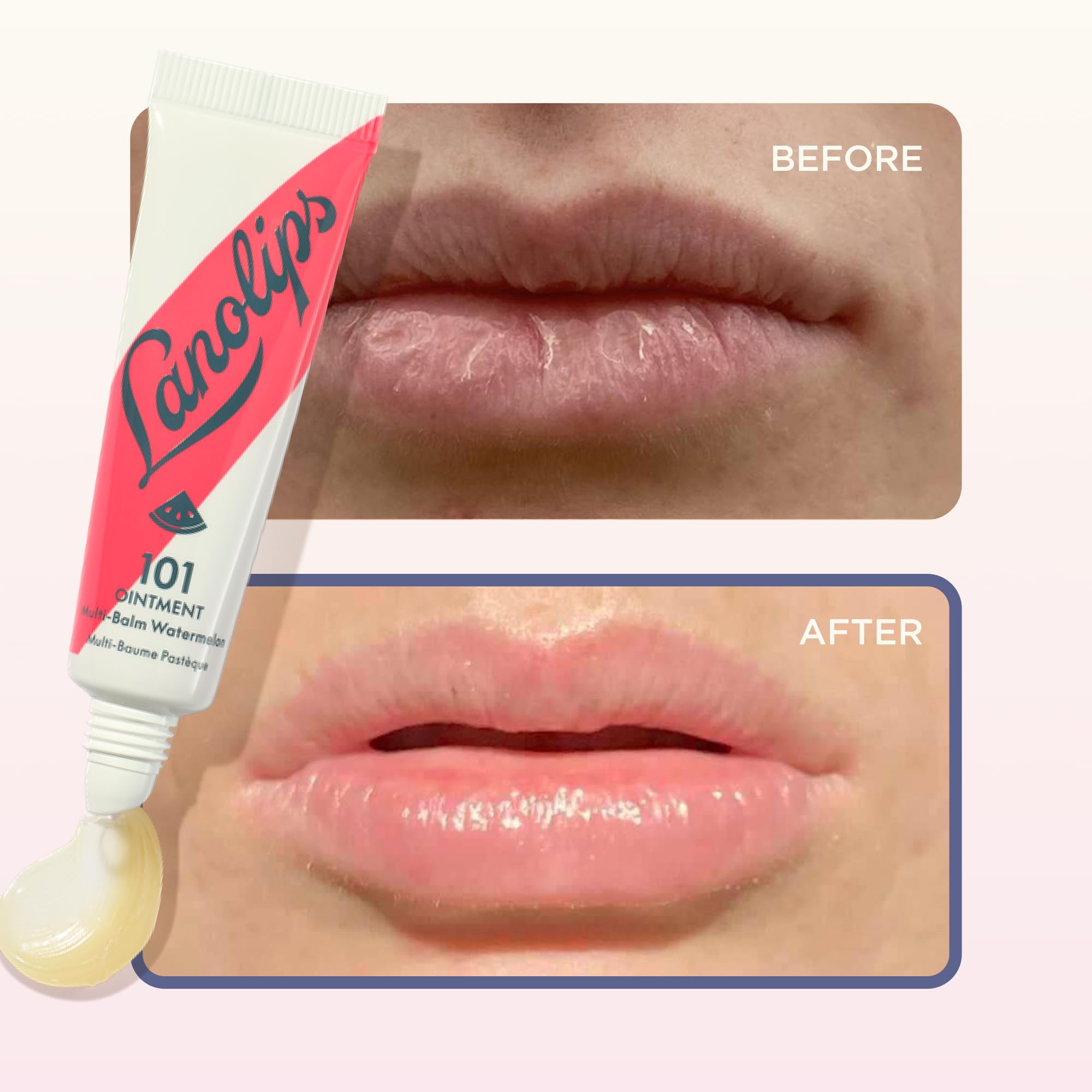 Lanolin 101 Multipurpose Ointment - Lanolin Lip Balm & Healing Ointment for Skin Barrier Repair - Moisturizer for Dry Lips, Cuticles & Elbows - No Petroleum Formula - Watermelon (0.35 oz) Lanolips uk supplements