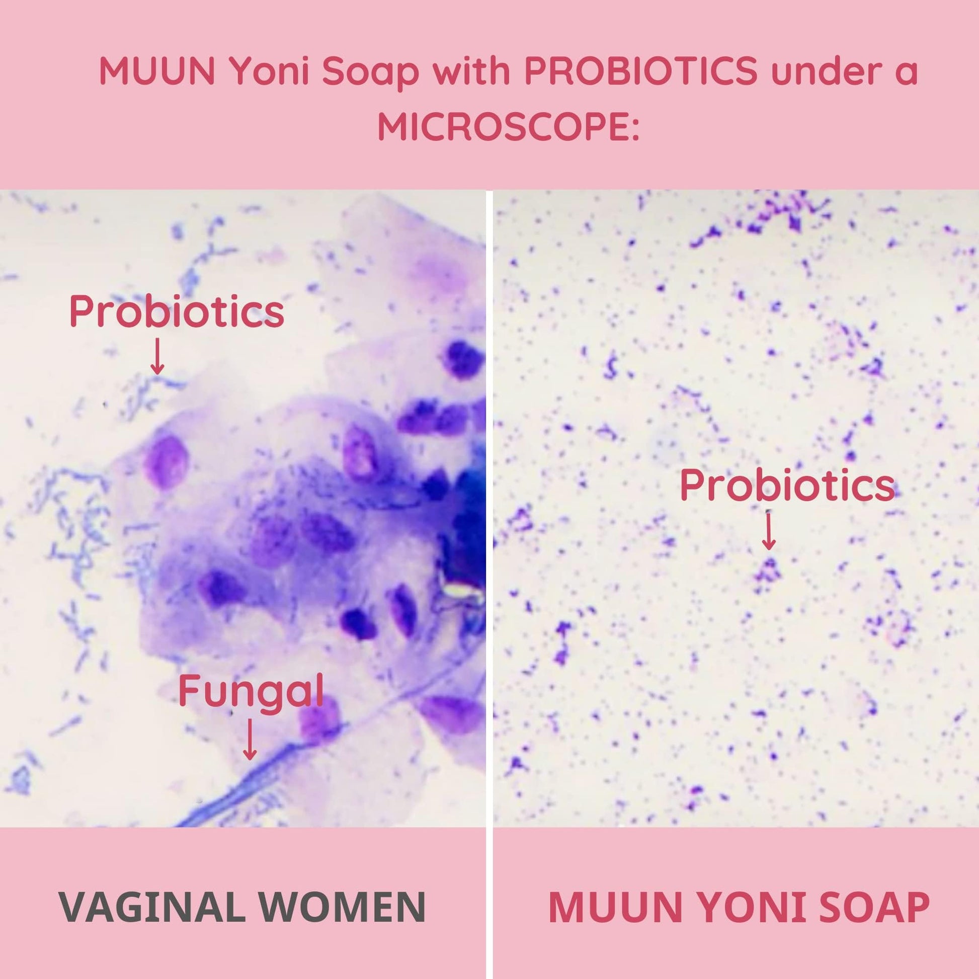 Muun Yoni Soap Bar - Pack 3 Ph Balance Probiotics & Natural Ingredients - Gentle Cleansing Formula Muun uk supplements