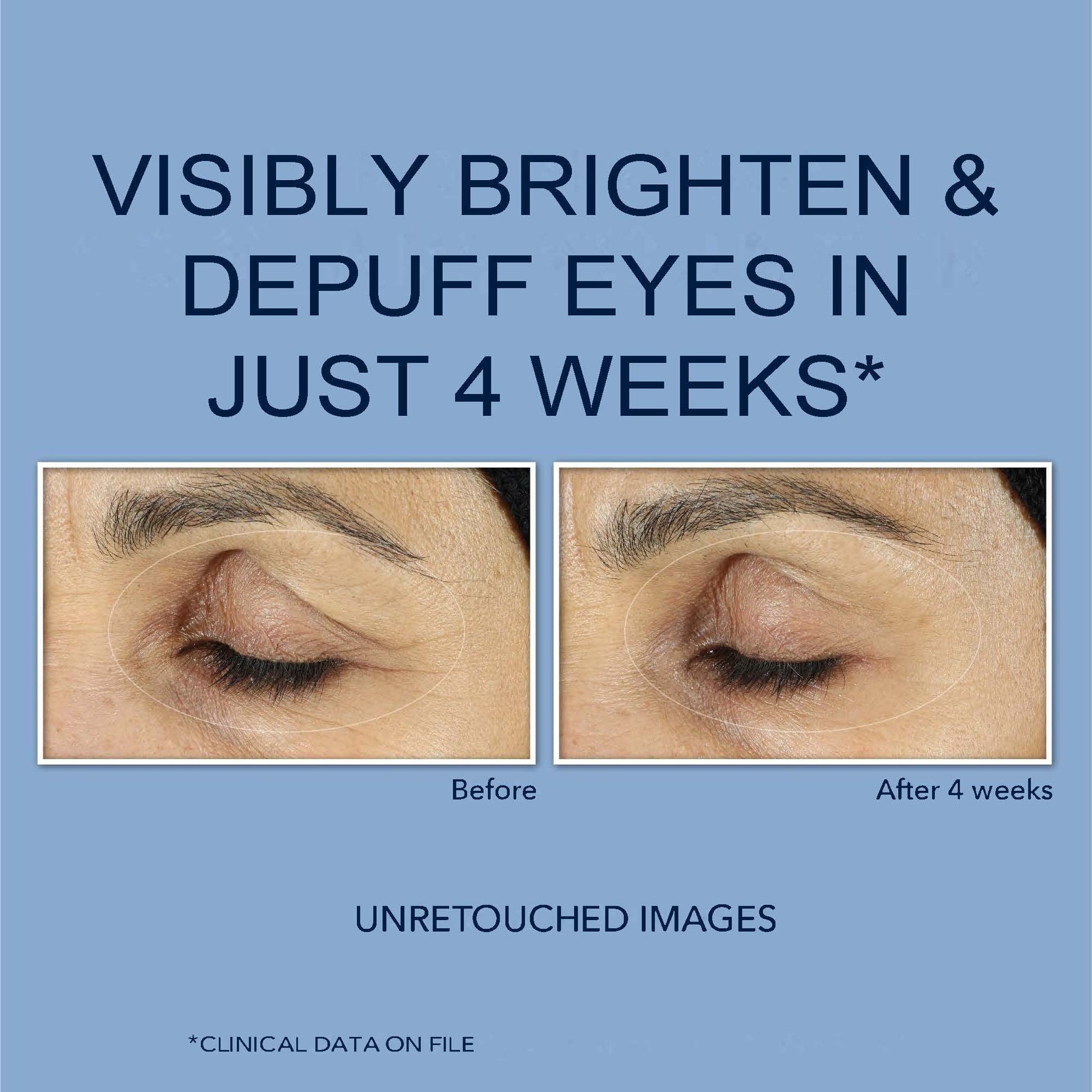 RoC Retinol Correxion Eye Cream Mini for Dark Circles & Puffiness, Daily Wrinkle RoC uk supplements