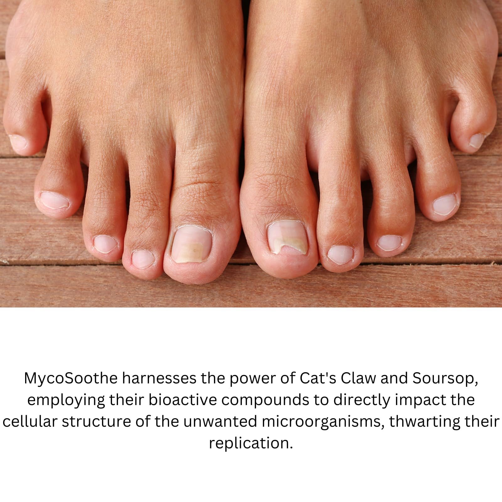 Phytage Labs MycoSoothe Advanced Hair, Skin, Nail & Immunity Support Formula - 60 Capsules Phytage Labs uk supplements