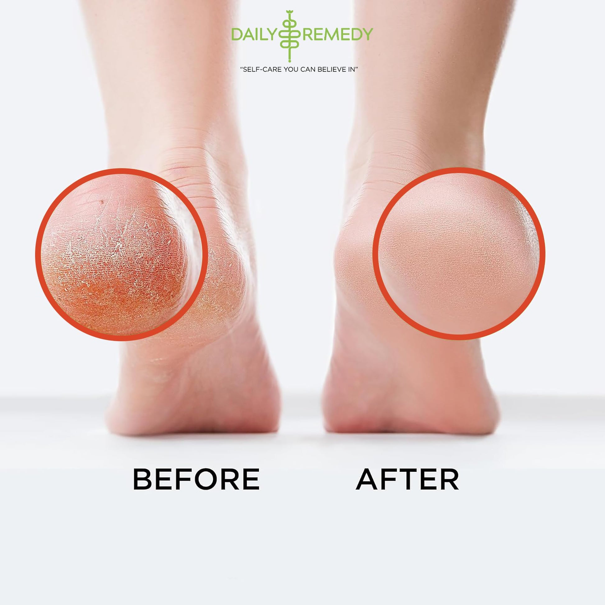 Muscle Relief Foot Soak with Epsom Salt, Made in USA, Soothe Foot Aches, Muscle Pain DAILY REMEDY uk supplements