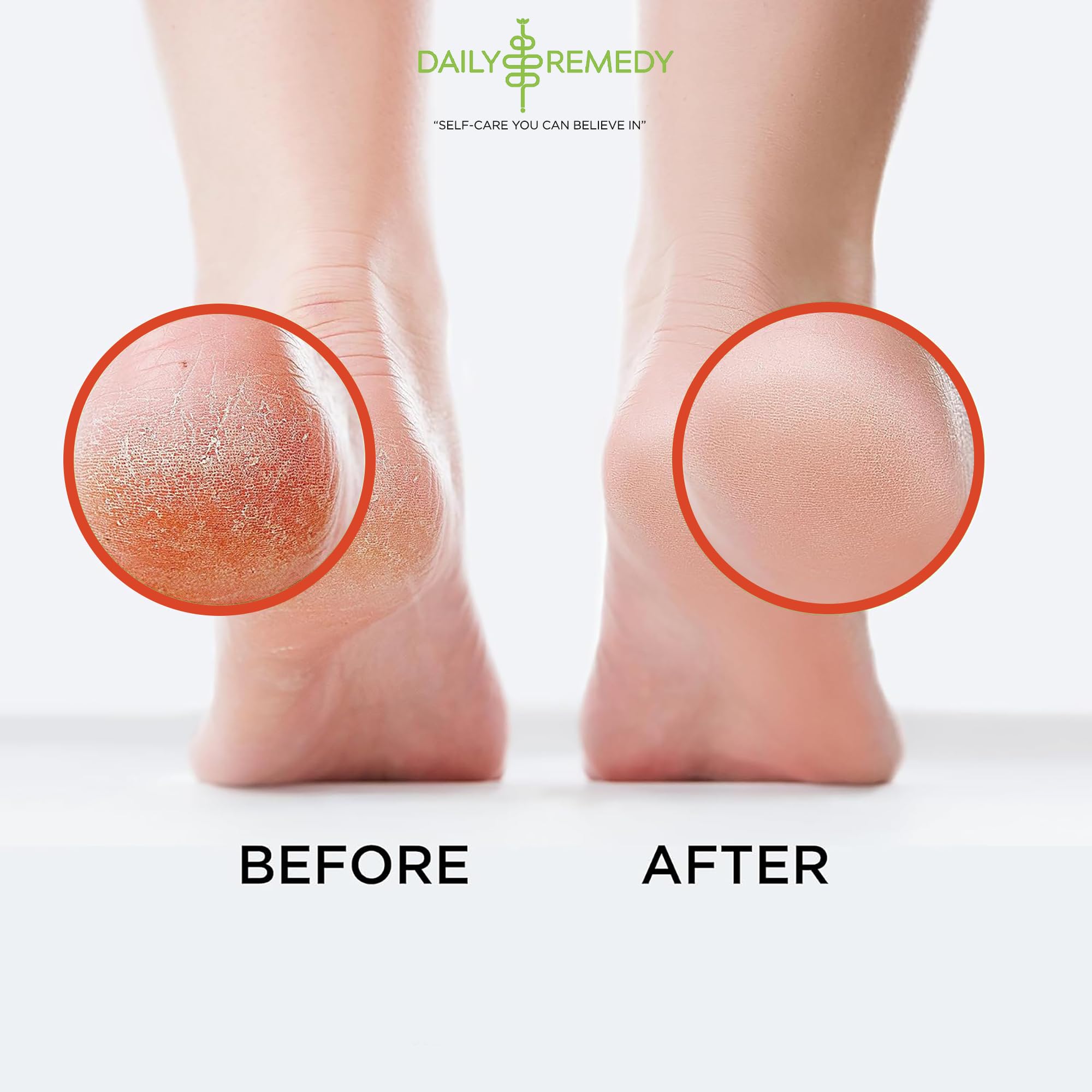Muscle Relief Foot Soak with Epsom Salt, Made in USA, Soothe Foot Aches, Muscle Pain DAILY REMEDY uk supplements