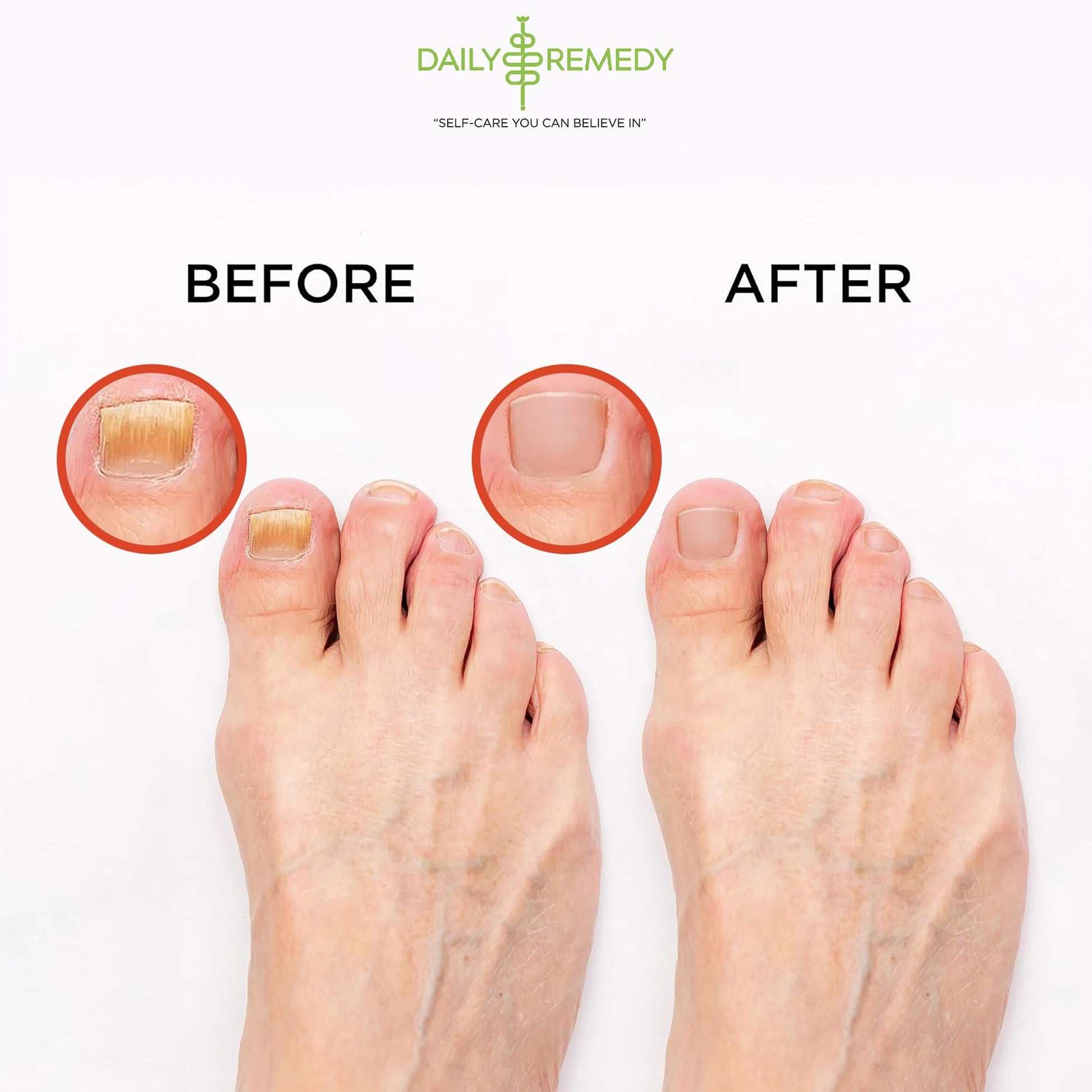 Muscle Relief Foot Soak with Epsom Salt, Made in USA, Soothe Foot Aches, Muscle Pain DAILY REMEDY uk supplements