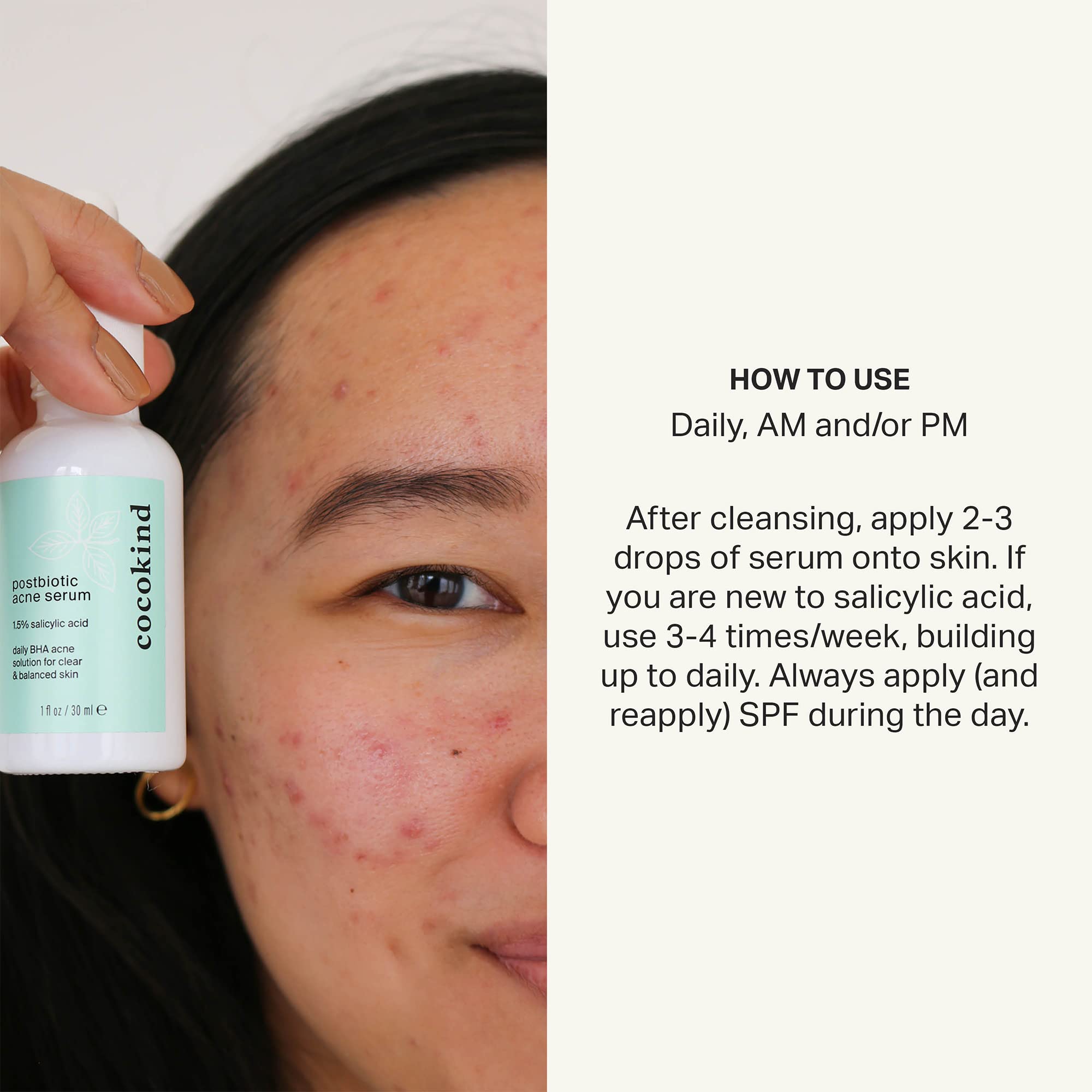 Cocokind Postbiotic Acne Serum, Salicylic Acid Serum and BHA Liquid Exfoliant - Exfoliating, Brightening and Hydrating Serum Cocokind uk supplements