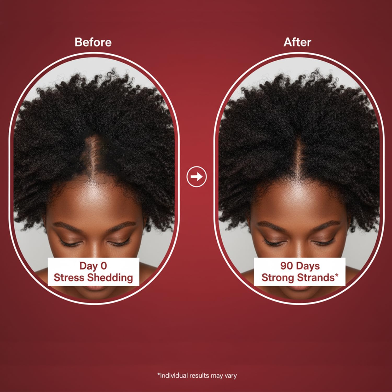 Lumin Hair Growth Gummies for Black Women, 60 Vegan Gummies, Daily Hair Nourishment with Biotin, Collagen & Botanical Extracts, Supports Healthy Hair Growth & Strength Lumin Hair uk supplements