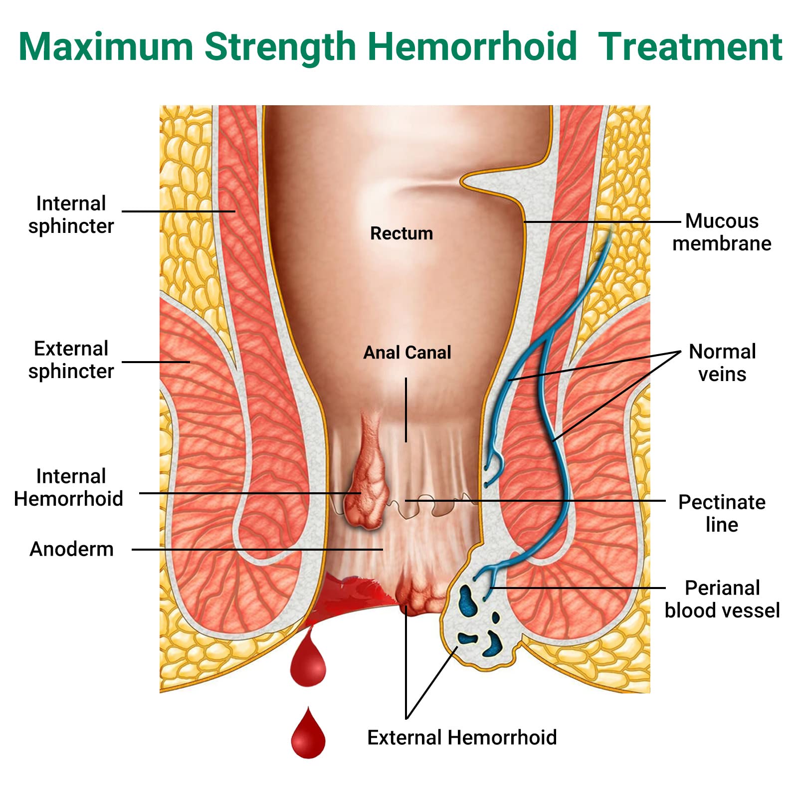 Hemorrhoid Treatment Ointment, Maximum Strength Treatment & Fast Relief for Pain, Itching, Burning, Swelling, Fissure, Bleeding, Discomfort, Long-Lasting Internal & External Hemorrhoid Cream, (2-Pack) LMNOOP uk supplements