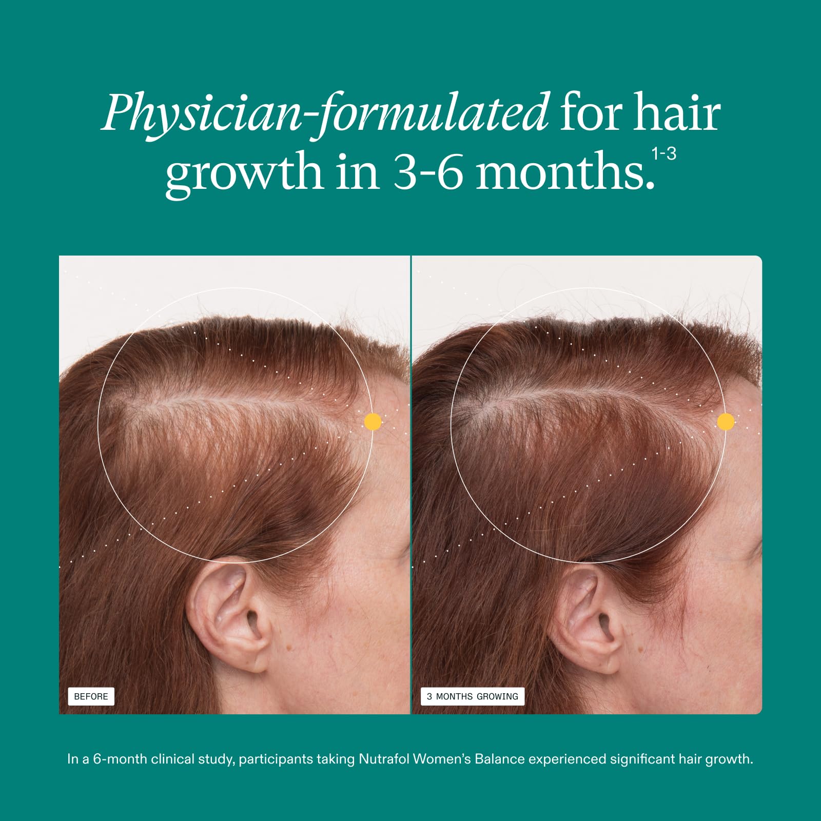 Nutrafol Women's Balance Hair Growth Supplements, Ages 45 and Up, Clinically Proven for Visibly Thicker Hair and Scalp Coverage, Dermatologist Recommended - 1 Month Supply Nutrafol uk supplements