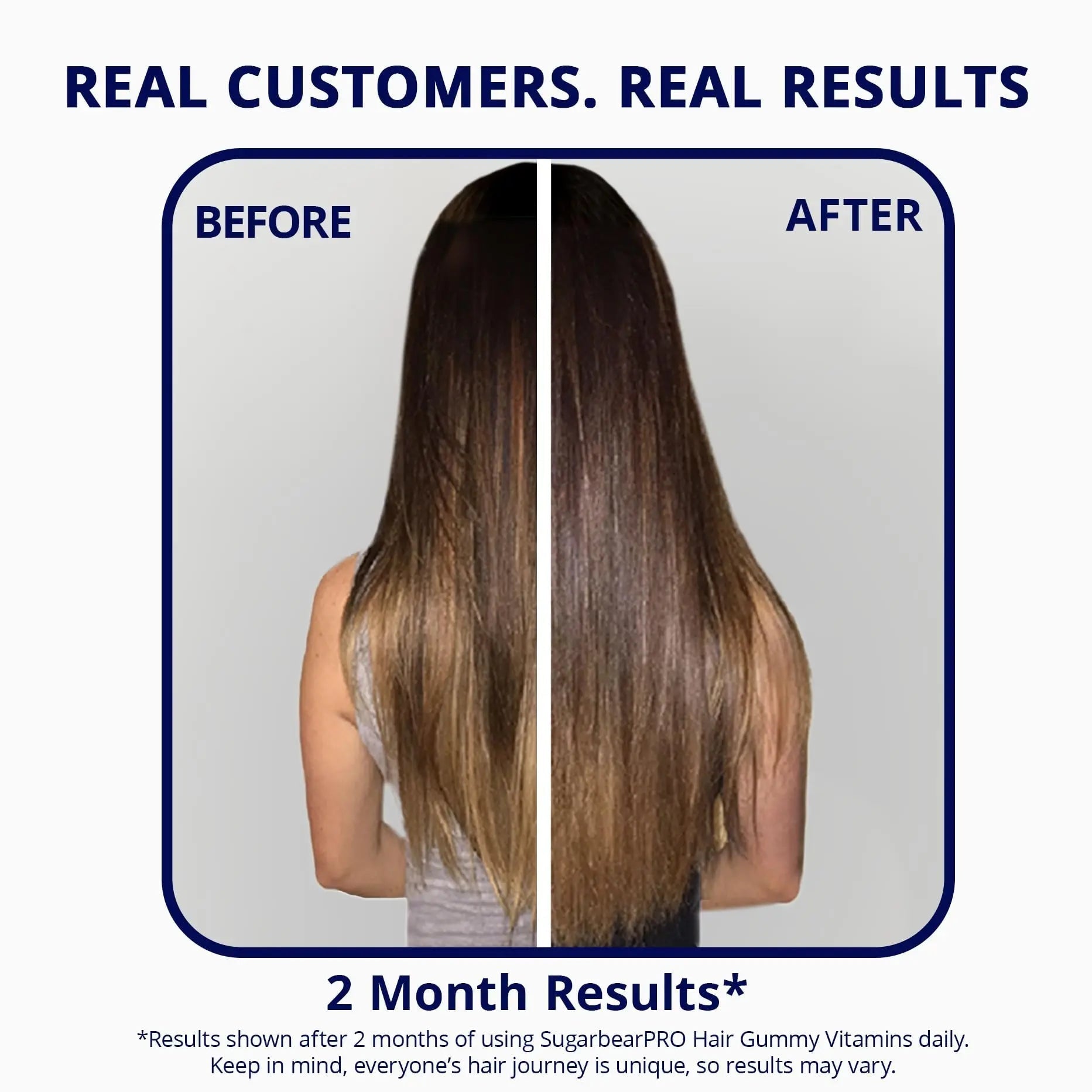 SugarBearPro Hair Vitamin Gummy 3 Month Supply Extra Strength Biotin 6000mcg, Growth for Men & Women, Vegan Vitamin B12 SugarBearHair uk supplements