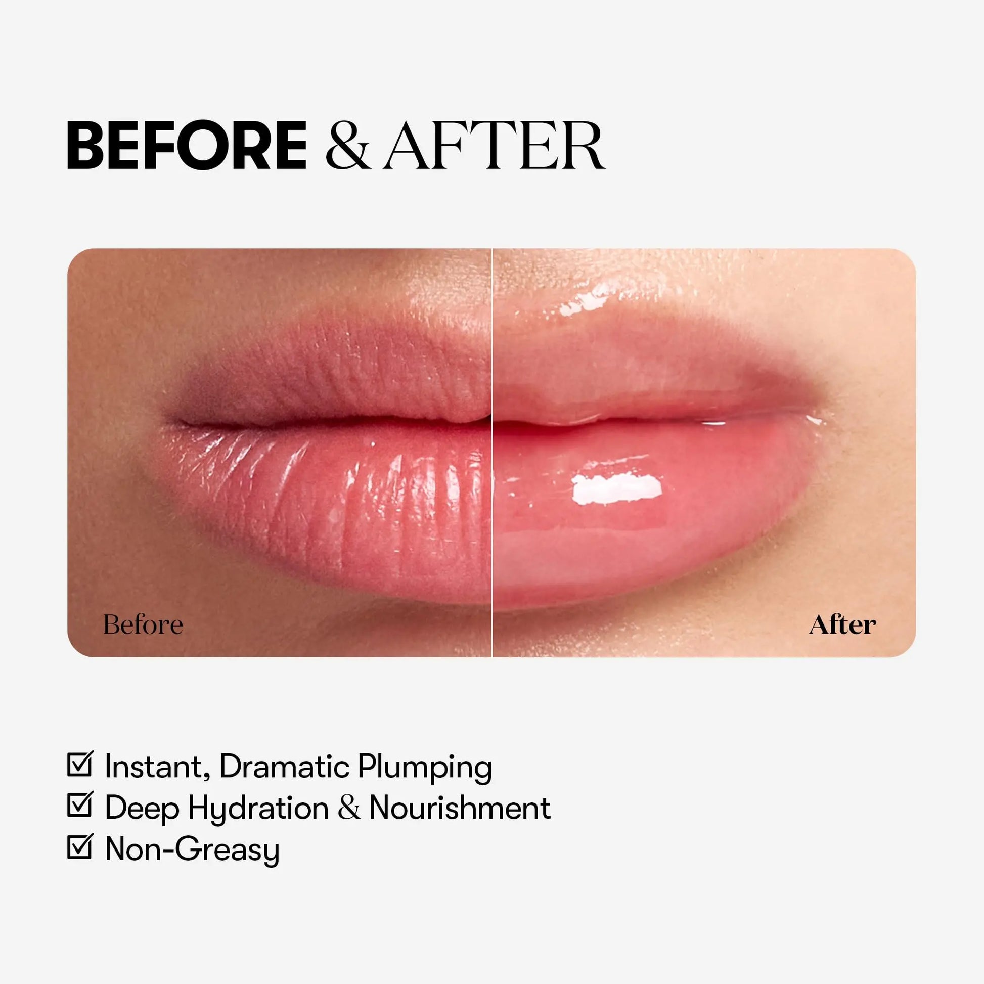 VTCOSMETICS Reedle Shot Lip Plumper, 0.15 oz (4.3 g), Moisturizing, Transparent, Lip Gloss, Fragrance-free, Korean Cosmetics (Expert) VT COSMETICS uk supplements