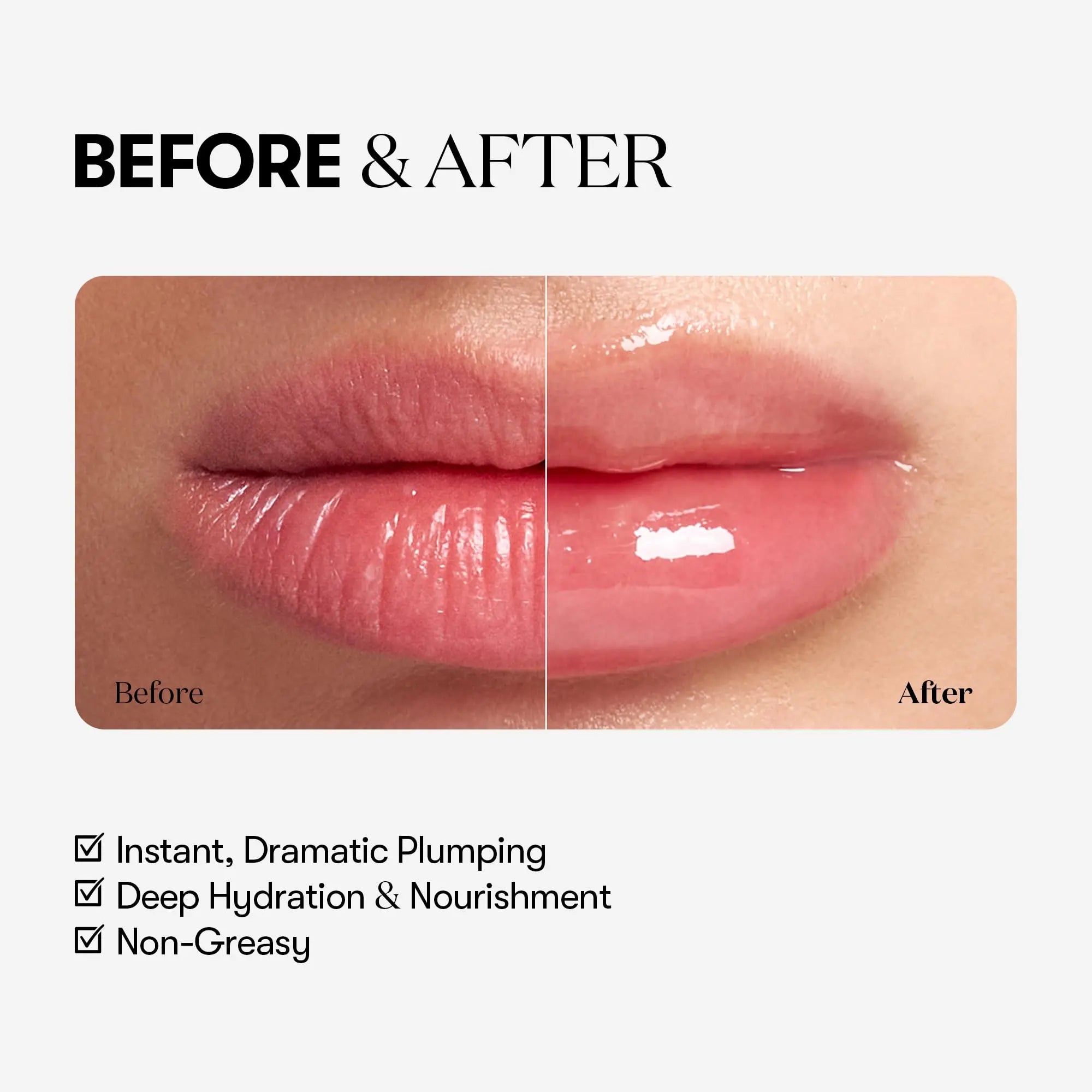 VTCOSMETICS Reedle Shot Lip Plumper, 0.15 oz (4.3 g), Moisturizing, Transparent, Lip Gloss, Fragrance-free, Korean Cosmetics (Expert) VT COSMETICS uk supplements
