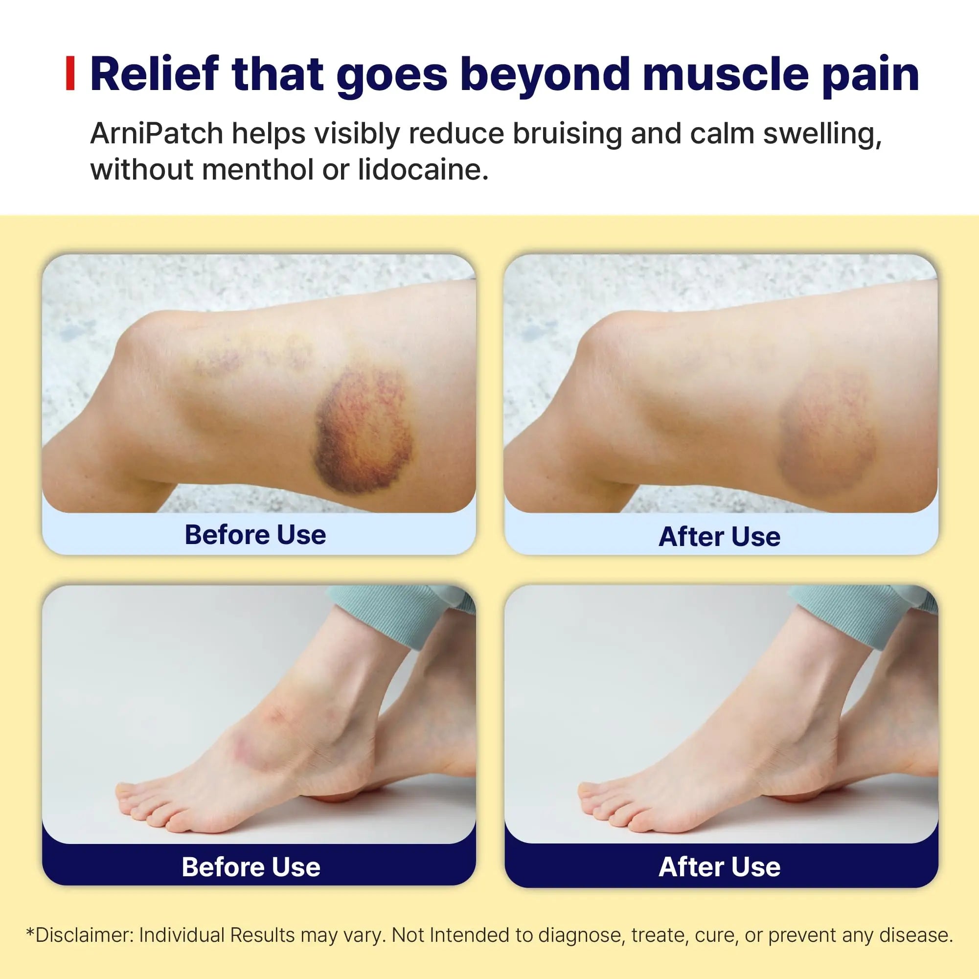 Arnica Hydrogel Pain Relief Patches | Natural Relief for Muscle, Joint, Bruises & Swelling | Flexible, Non-Greasy & Long-Lasting | Great for Back, Knee & Neck Pain (3.9"x4.7", 10, Count) Wooshin Labottach uk supplements