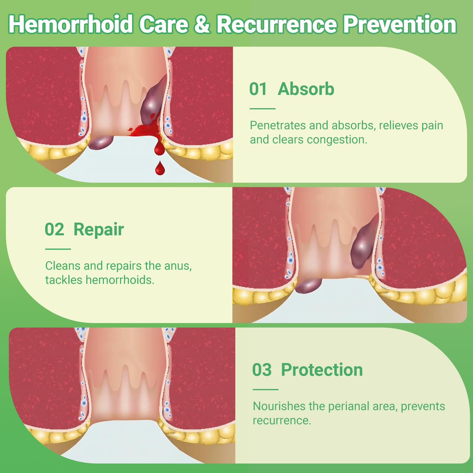 Hemorrhoid Treatment Ointment - Tubesmaximum Strength - Fast Relief from Pain, Itching, Burning, Swelling & Fissures | Natural Aloe & Vitamin E | Travel-Friendly10g x 5 Pieces Tubes - (1.76 Oz) yimimde uk supplements