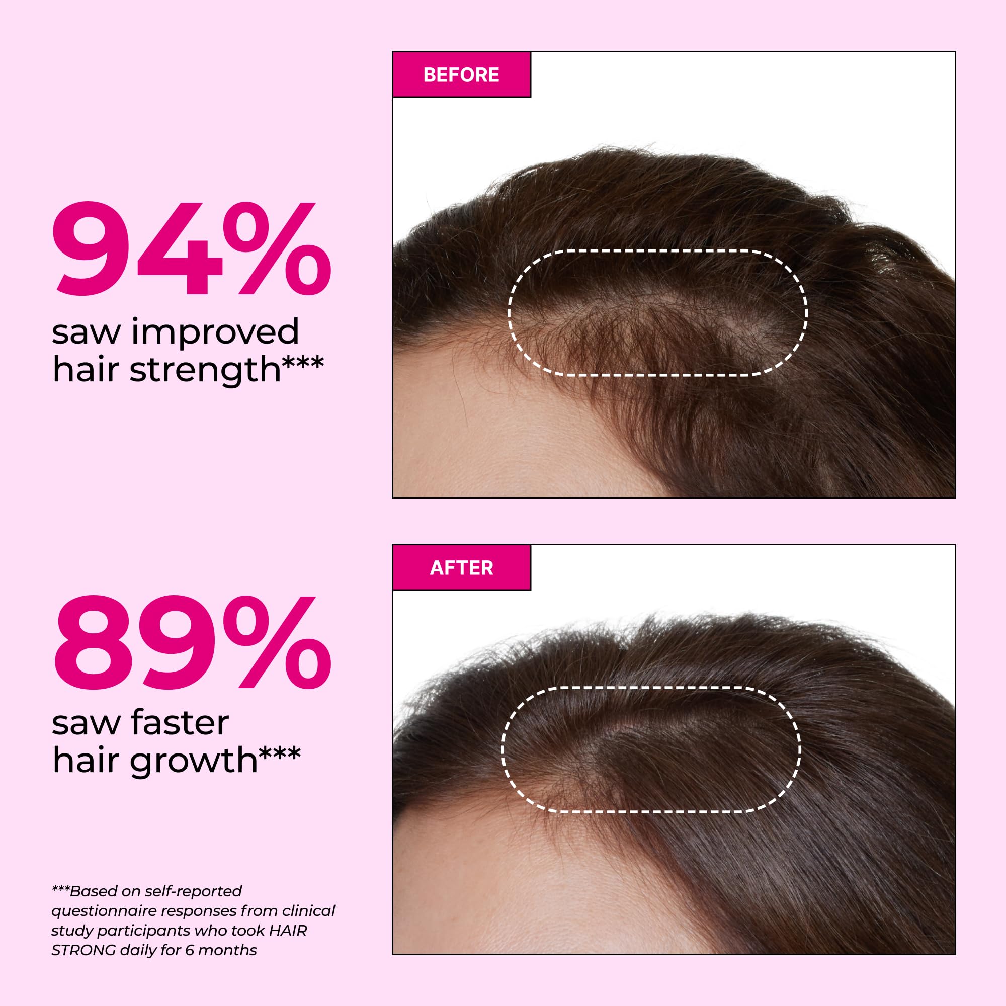 HUM Hair Strong Daily Hair Growth Gummies with Biotin, Zinc, Vitamin B12 to Support Growth, Folic Acid & Vitamin B12 Gummy Vitamins for Healthy Hair Support for Women and Men, 60 Gummies HUM uk supplements