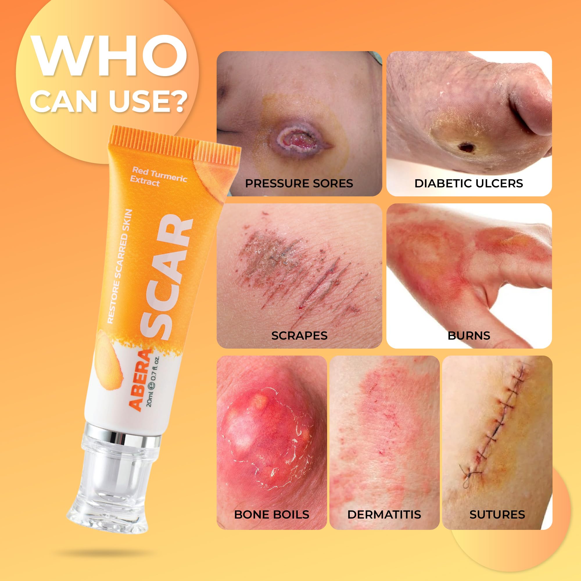 ABERA Scar Removal Cream for Women and Men - Rapid Repair of New Old Scars, Spots, Burns All Natural Treatment with Vitamin E, Alanine, Collagen (1 Box + 3 Eye Patch) ABERA uk supplements