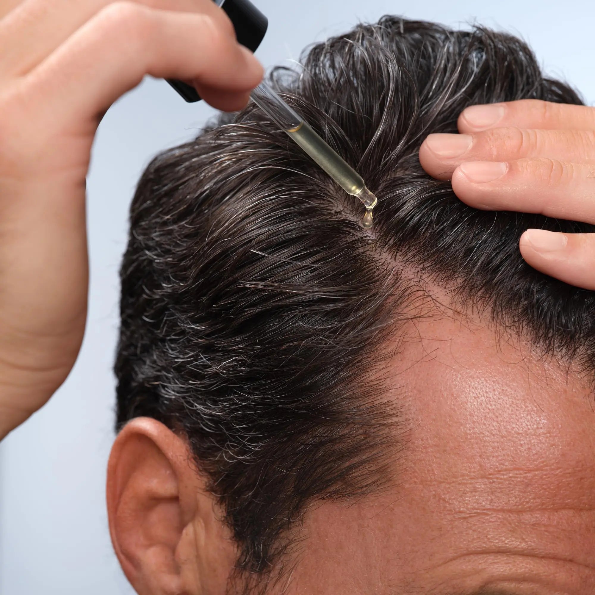Caldera + Lab The Hair Serum | Men’s Thickening Serum for Thinning & Receding Hair, Supports Fuller & Stronger-Looking Hair, Dermatologically Tested - All Hair Types Caldera + Lab uk supplements