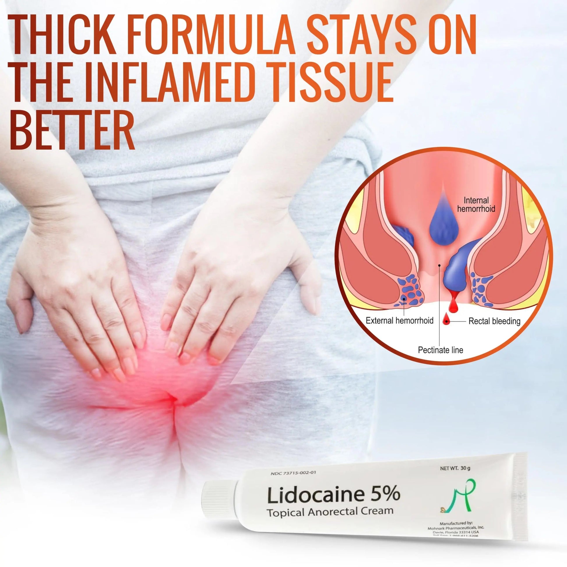 Mohnark Maximum Strength Lidocaine Hemorrhoid Treatment Cream for External and Internal Hemorrhoids Treatment Burn Itch Pain Relief Anal Cream Topical Anorectal Numbing Cream- 30 Gram Tube Made in USA MOHNARK uk supplements