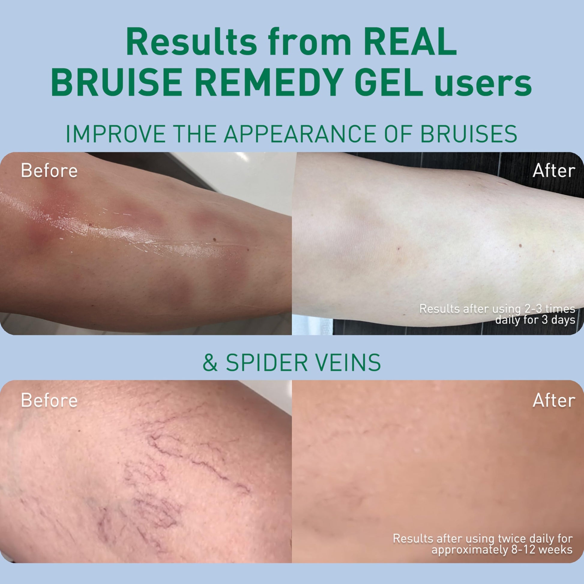 PROcure Arnica & MSM Bruise Remedy Gel – Paraben-Free, Unscented Arnica Montana Gel for Bruising, Spider Veins & Skin Discoloration – 2 Pack PROcure uk supplements