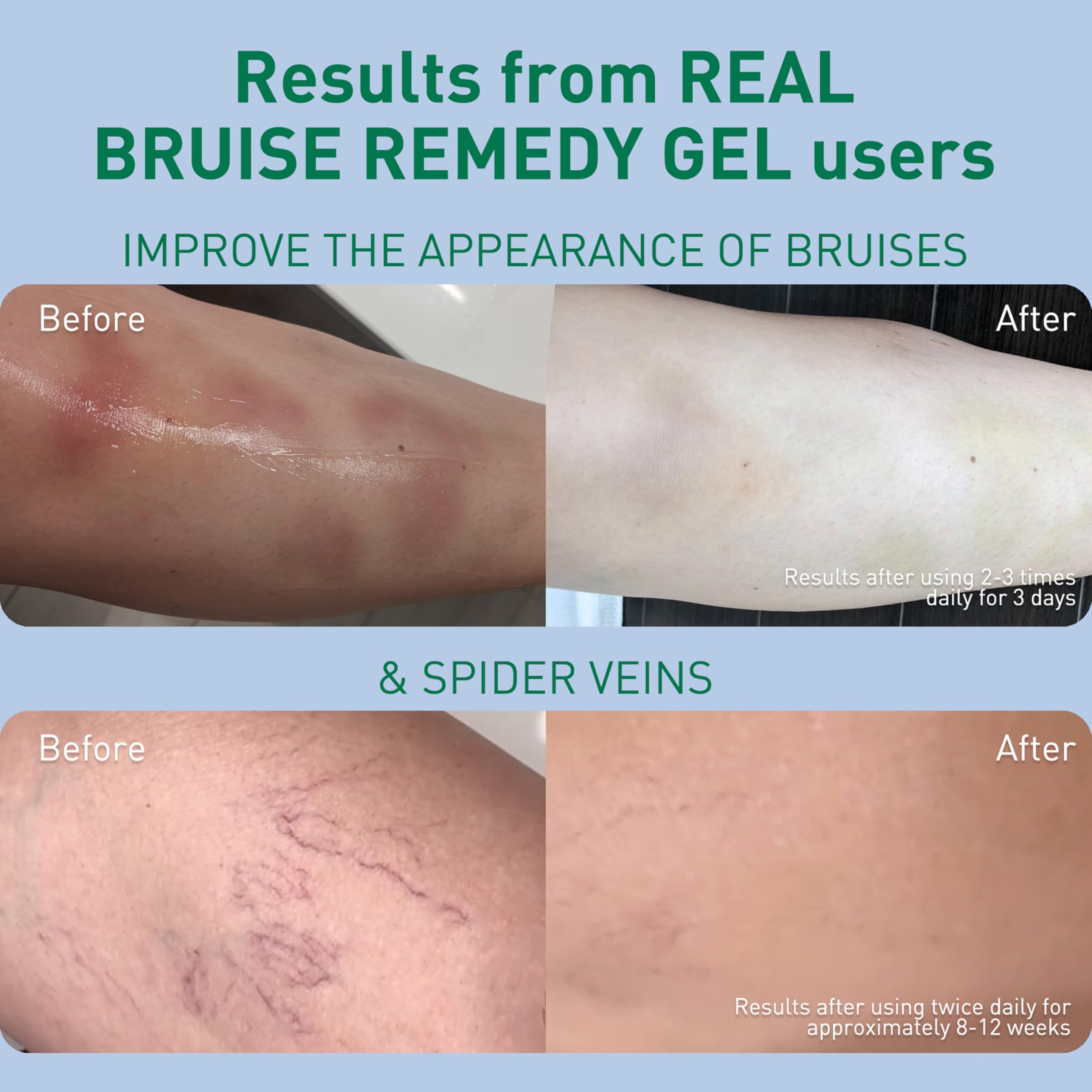 PROcure Arnica & MSM Bruise Remedy Gel – Paraben-Free, Unscented Arnica Montana Gel for Bruising, Spider Veins & Skin Discoloration – 2 Pack PROcure uk supplements