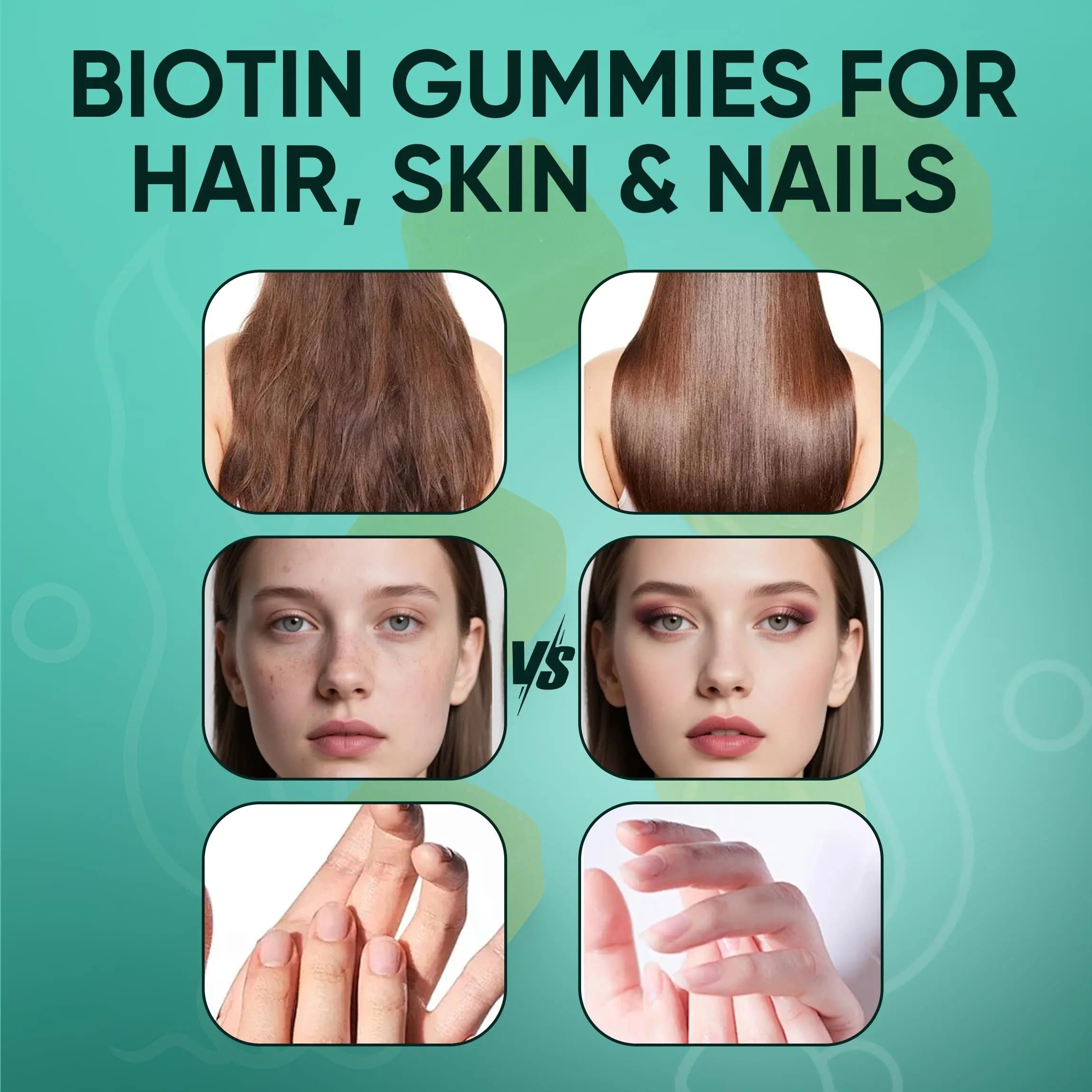 Neonomicon Balmbare Revive Gummies for Hair Loss - Sea Moss Gummies with Vitamin C, Vitamin E, Aloe Vera, Pearl Powder Supports Faster Hair Growth Neonomicon uk supplements