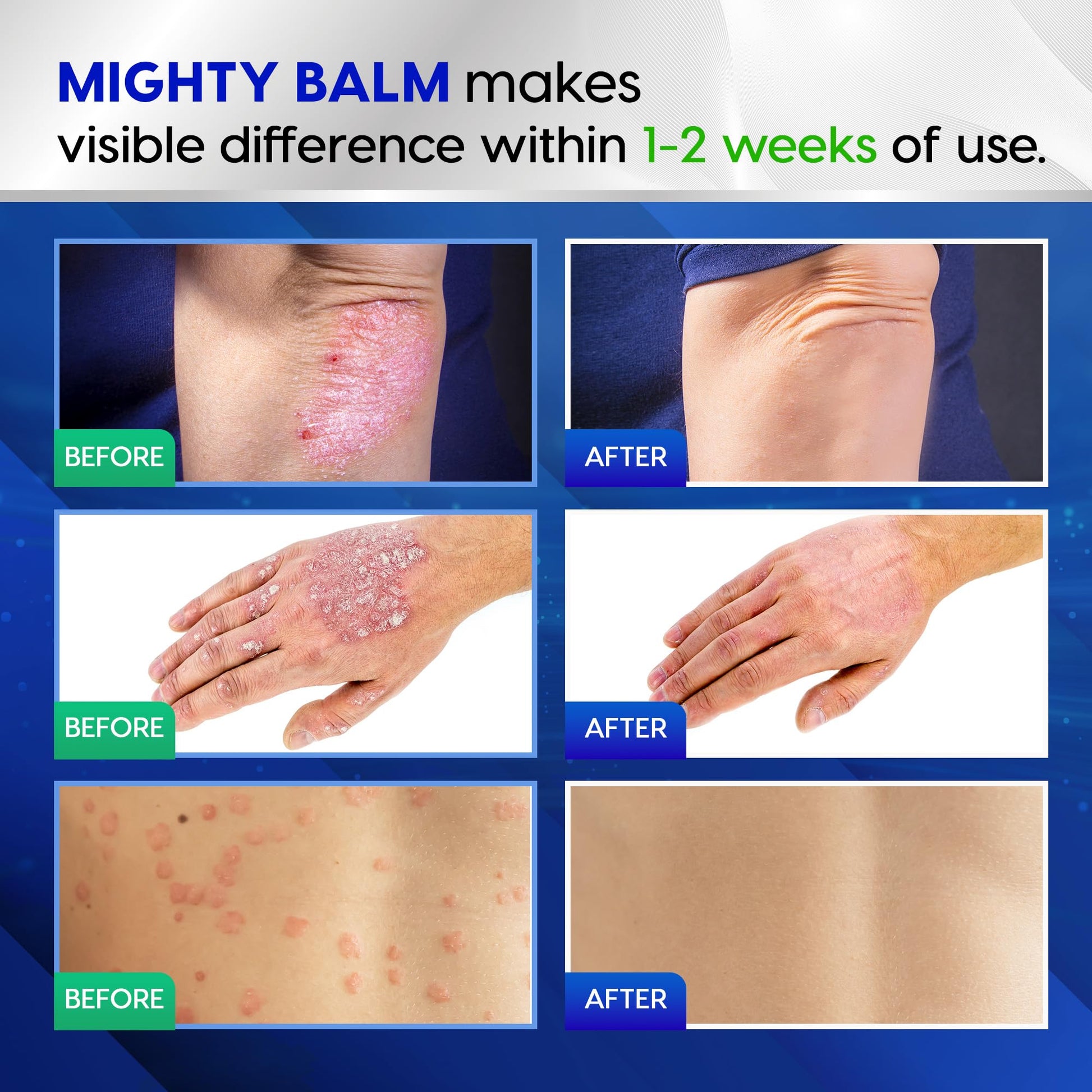 Tobcharm Antifungal Cream, Antifungal Cream for Skin, Ringworm Treatment for Humans Tobcharm uk supplements