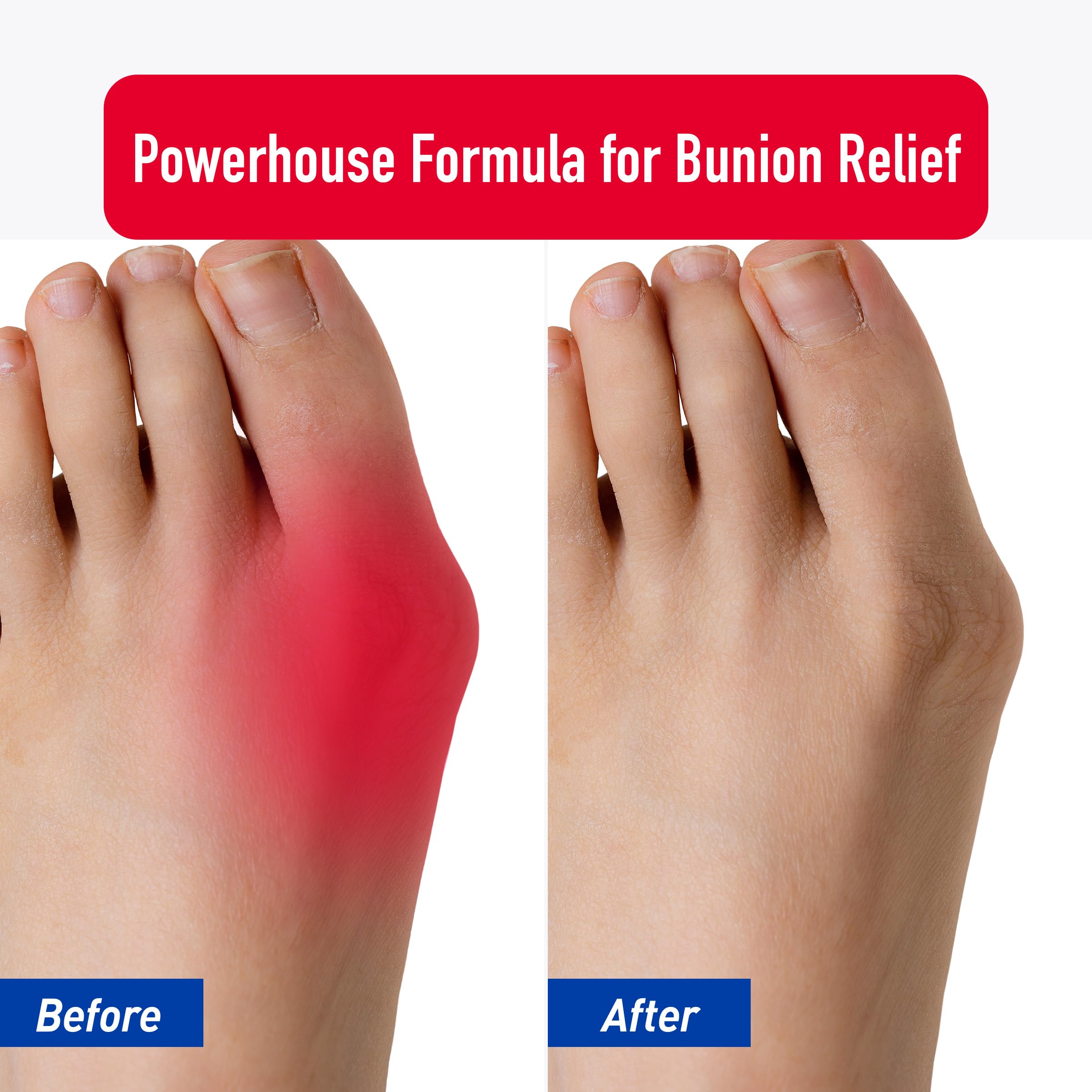 PROFOOT Bunion Relief Rub, White Heal&Rescue uk supplements