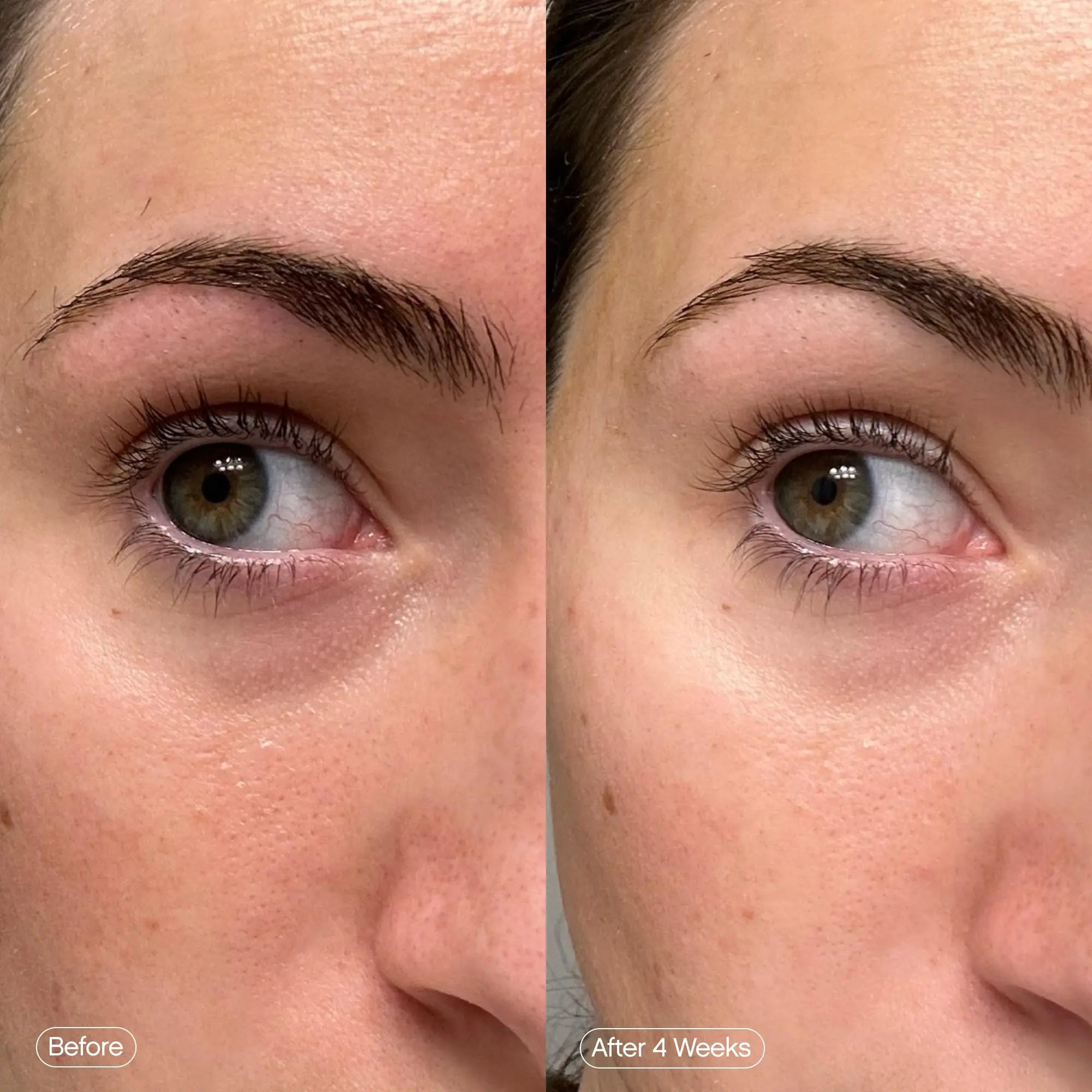 Topicals Faded Brightening Under Eye Masks | Patches to Depuff, Hydrate, Brighten and Cool | Reduce Dark Circles and Fine Lines | Contains Kojic Acid, Caffeine and Niacinamide (Set of 6) Topicals uk supplements