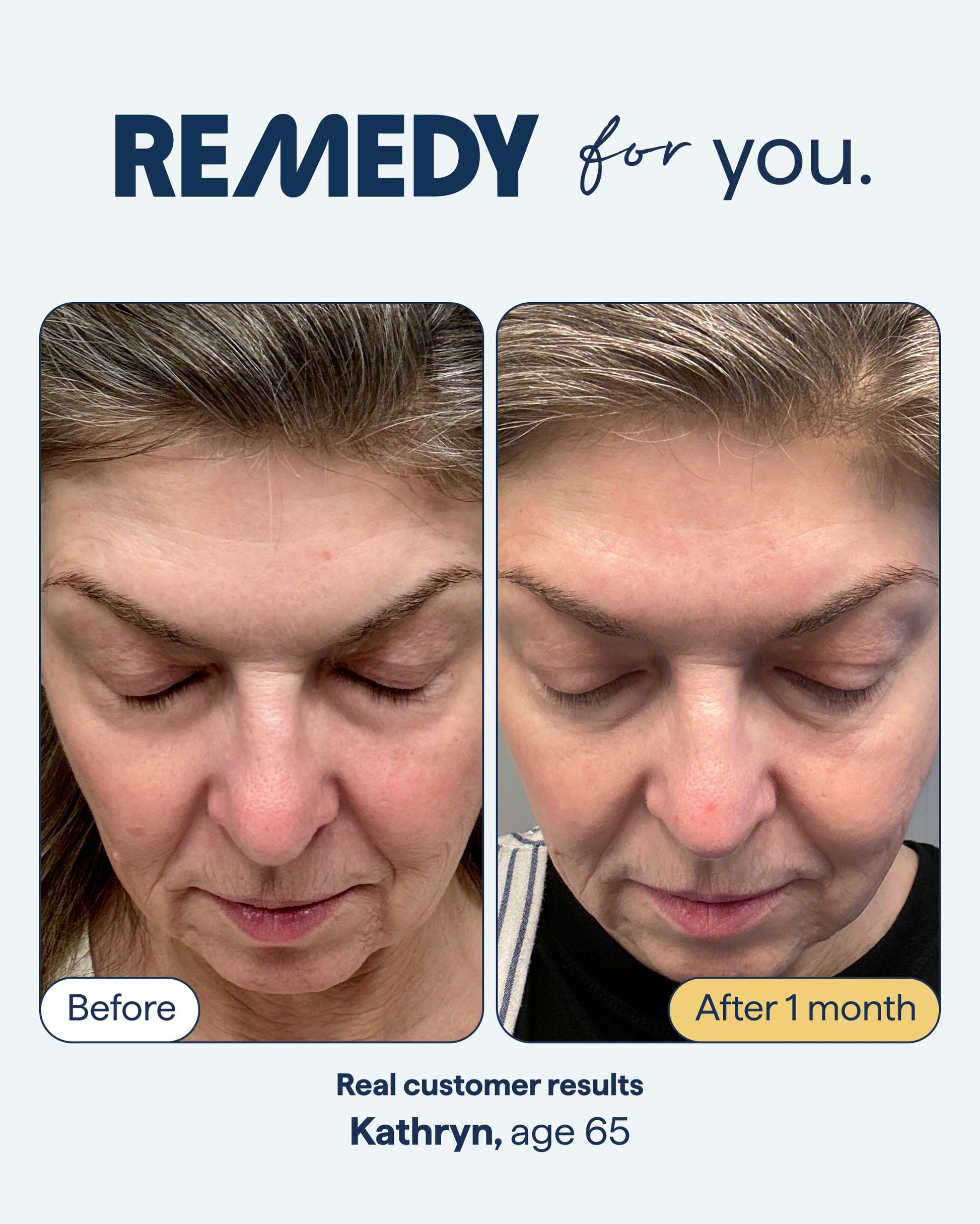 Remedy for Healthy Aging - Retinal, Resveratrol, Glycolic Acid, Argireline, Ferulic Acid, Matrixyl 3000 - Anti-Aging Treatment for Wrinkles, Uneven Texture & Tone - By Dermatologist Dr. Shah Remedy Science uk supplements