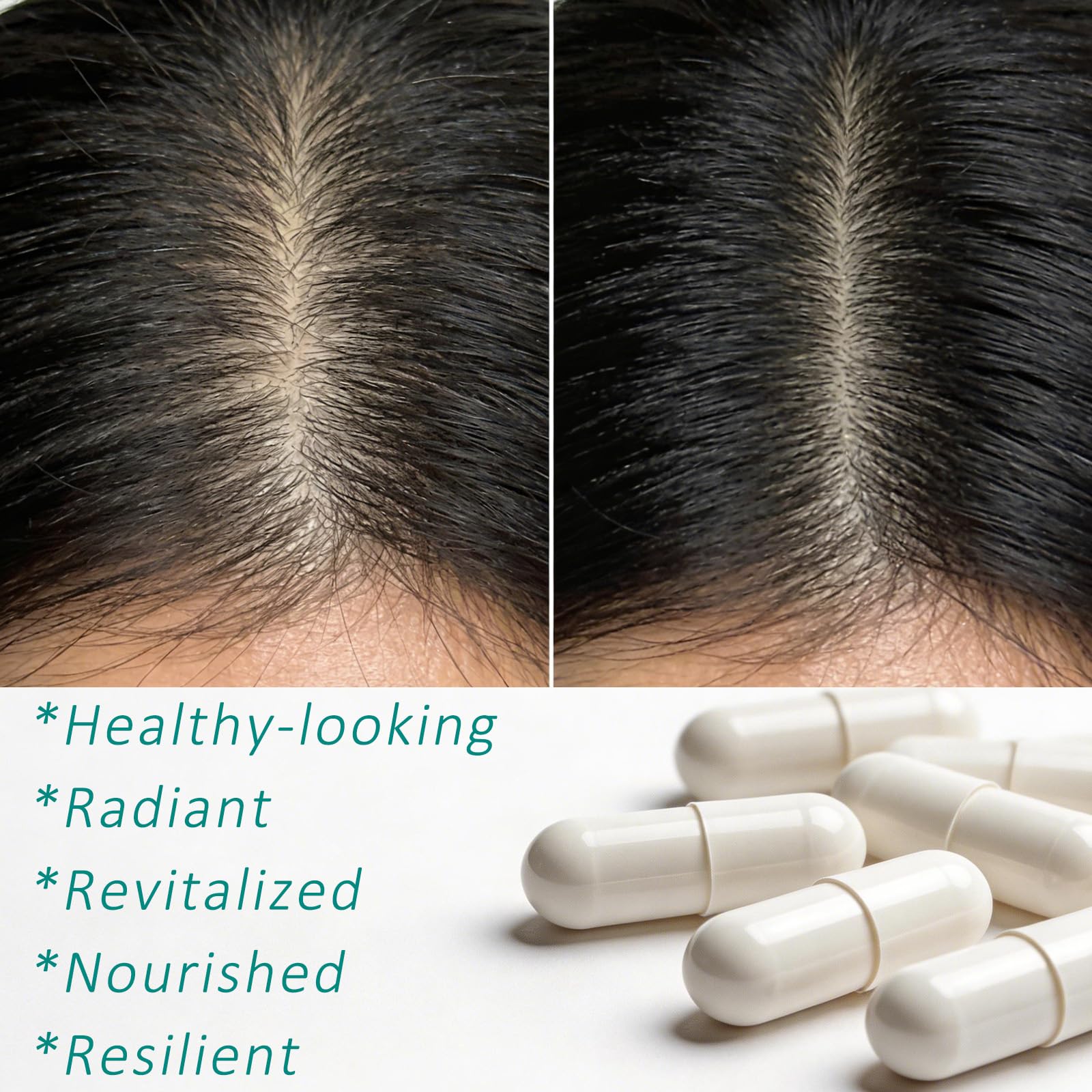 Hair Growth Biotin 10000mcg Supplement with Vitamins A C D E & Calcium - 30-in-1 Formula for Hair & Nails Support, for Women & Men, 30 Servings (1) WOJJ uk supplements