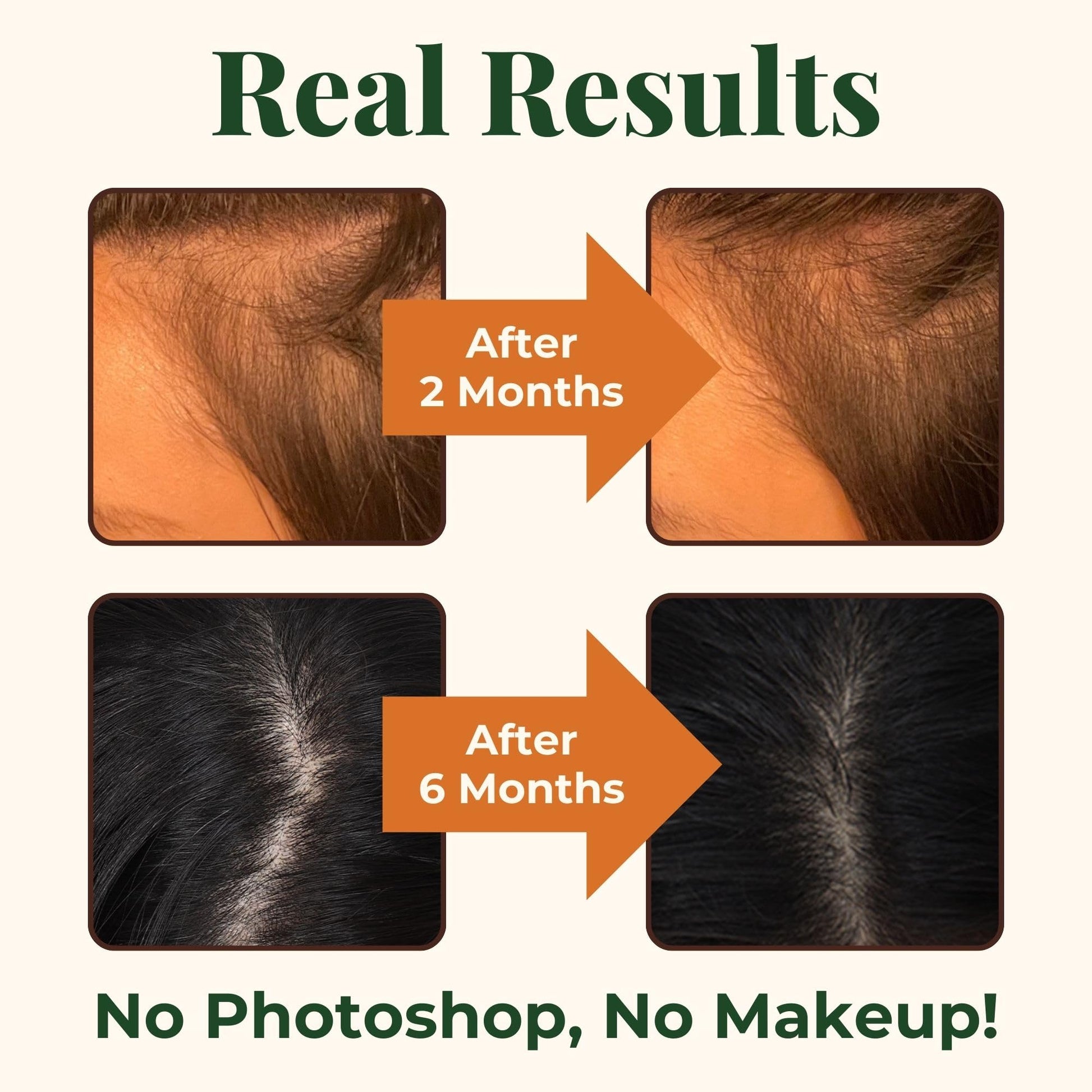 Heebin's Royal Hair, Brows & Lashes, Hair Growth Vitamins with Biotin 4000 mcg, Collagen Heebin's uk supplements