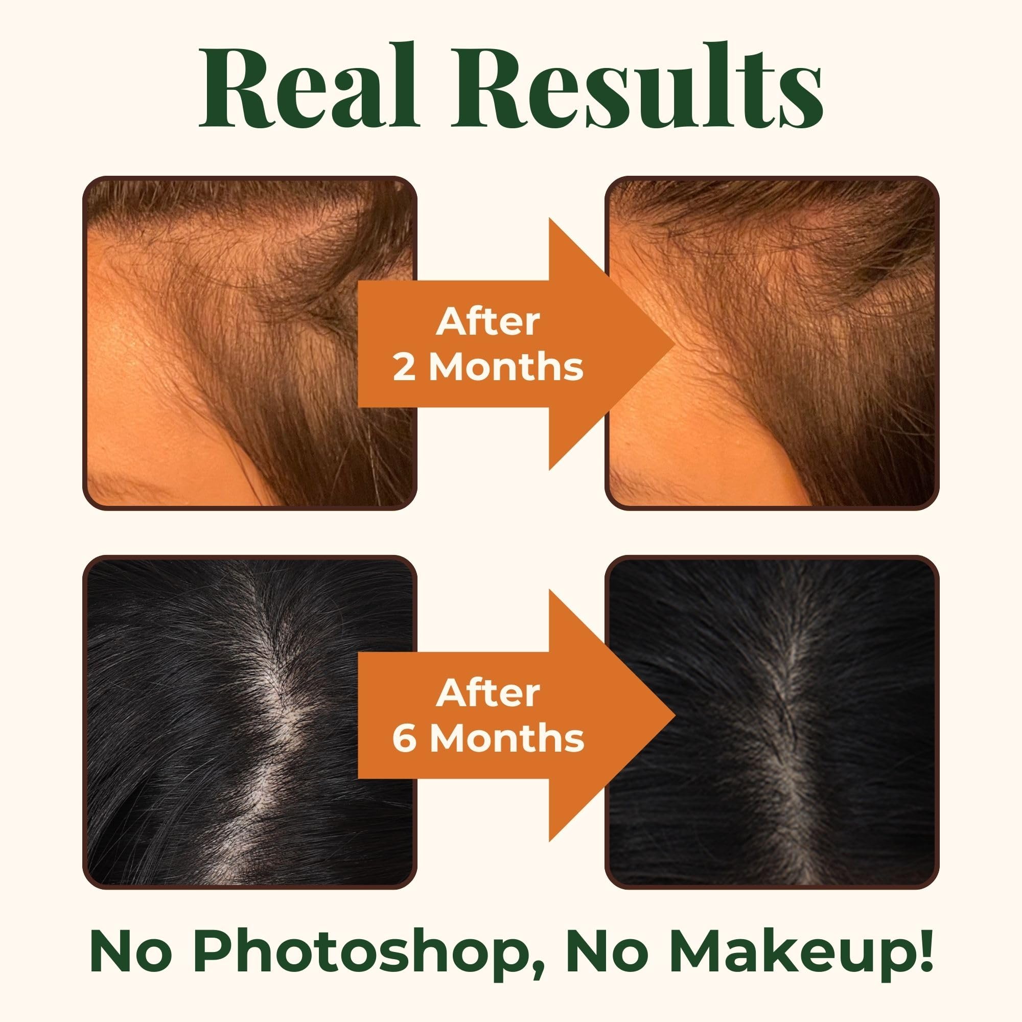 Heebin's Royal Hair, Brows & Lashes, Hair Growth Vitamins with Biotin 4000 mcg, Collagen Heebin's uk supplements