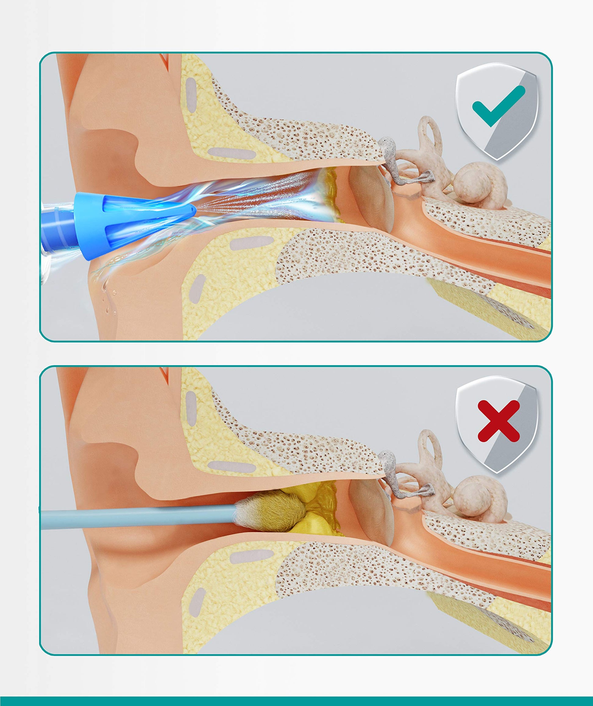 Medi Grade Ear Syringe Ear Wax Removal Kit with 3 Quad-stream Tips Medi Grade uk supplements