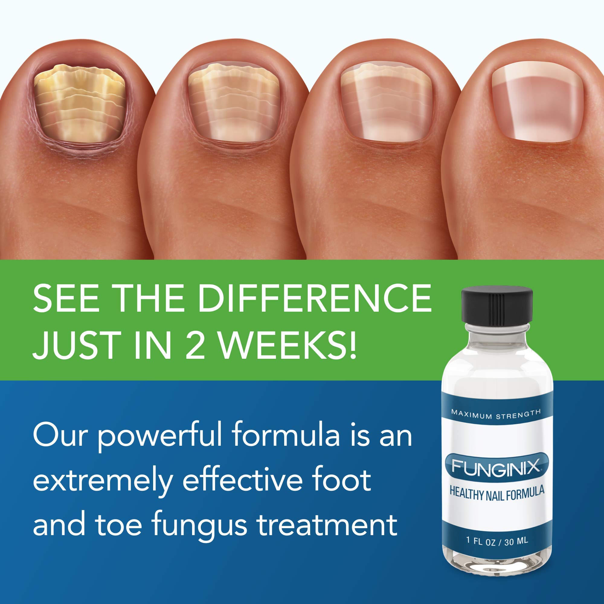 FUNGINIX Healthy Nail Formula - Finger And Toe Fungus Treatment, Made In USA, Foot FUNGINIX uk supplements