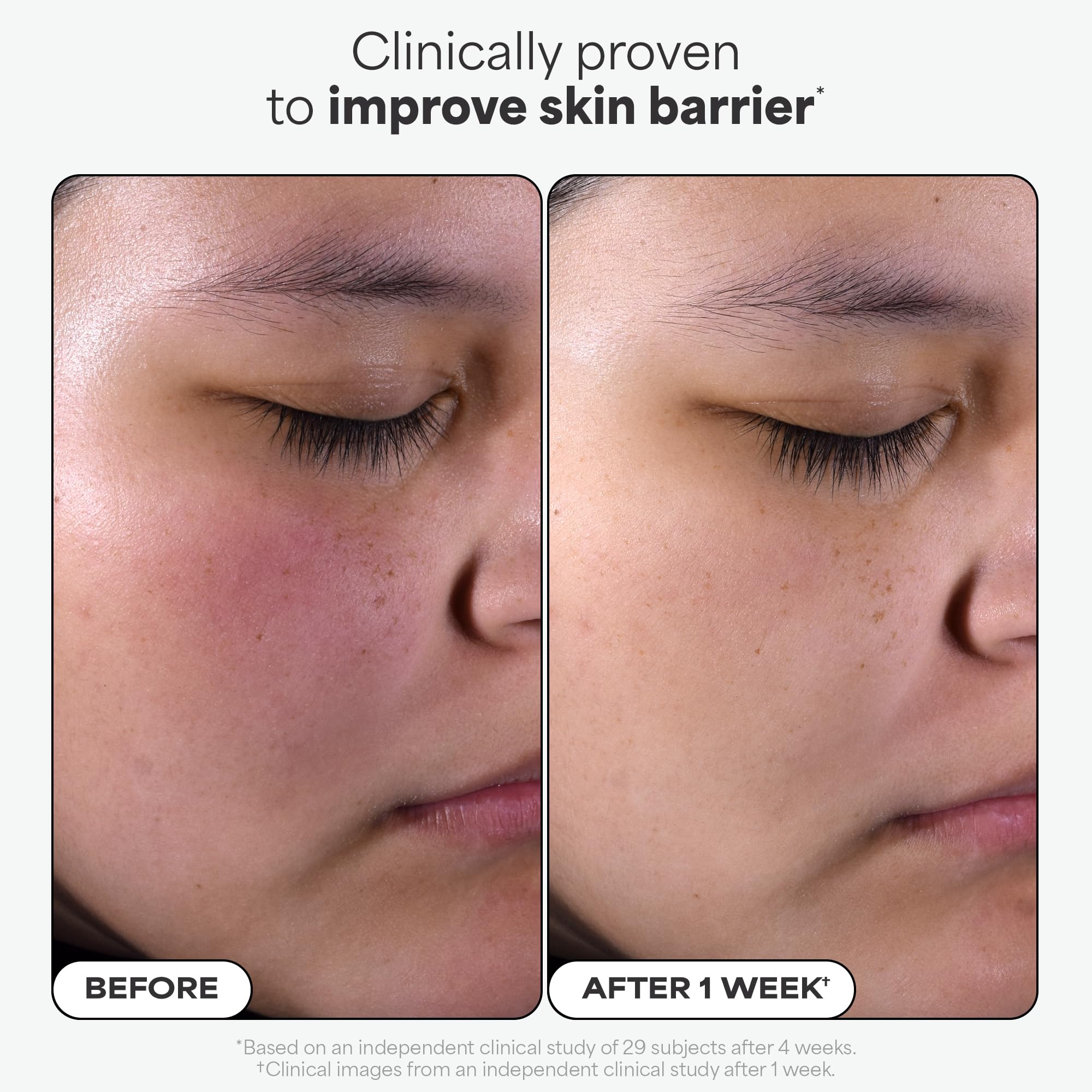 Paulas Choice--SKIN PERFECTING 2% BHA Liquid Salicylic Acid Exfoliant--Facial Exfoliant for Blackheads, Enlarged Pores, Wrinkles & Fine Lines, 4 oz Bottle Paula's Choice uk supplements