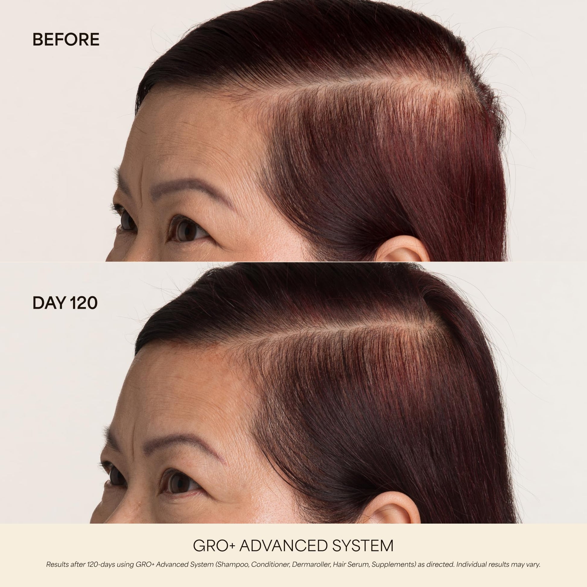 VEGAMOUR GRO+ Advanced Hair Growth Vitamin Supplements - Boosts Hair Growth & Density - 30 Pill Packs/Box VEGAMOUR uk supplements