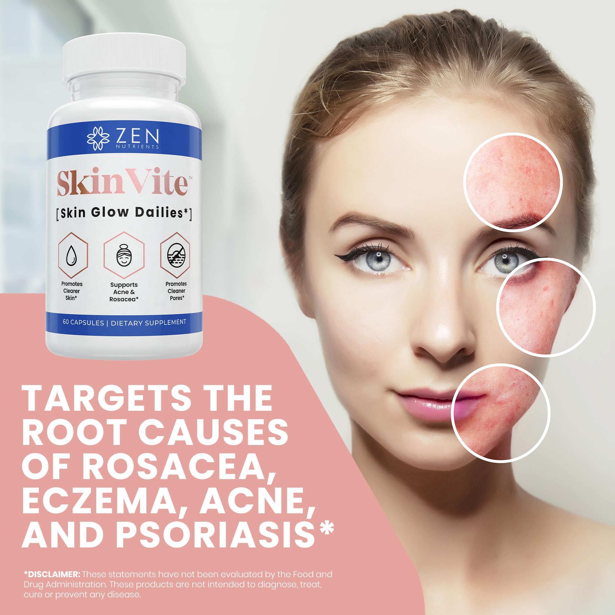Zen Nutrients SkinVite Natural Skin Supplement for Women, Men & Teens - Hormonal Breakouts & Clear Skin Support Supplement - Detoxifying Vitamin for Acne and Digestion Support Zen Nutrients uk supplements