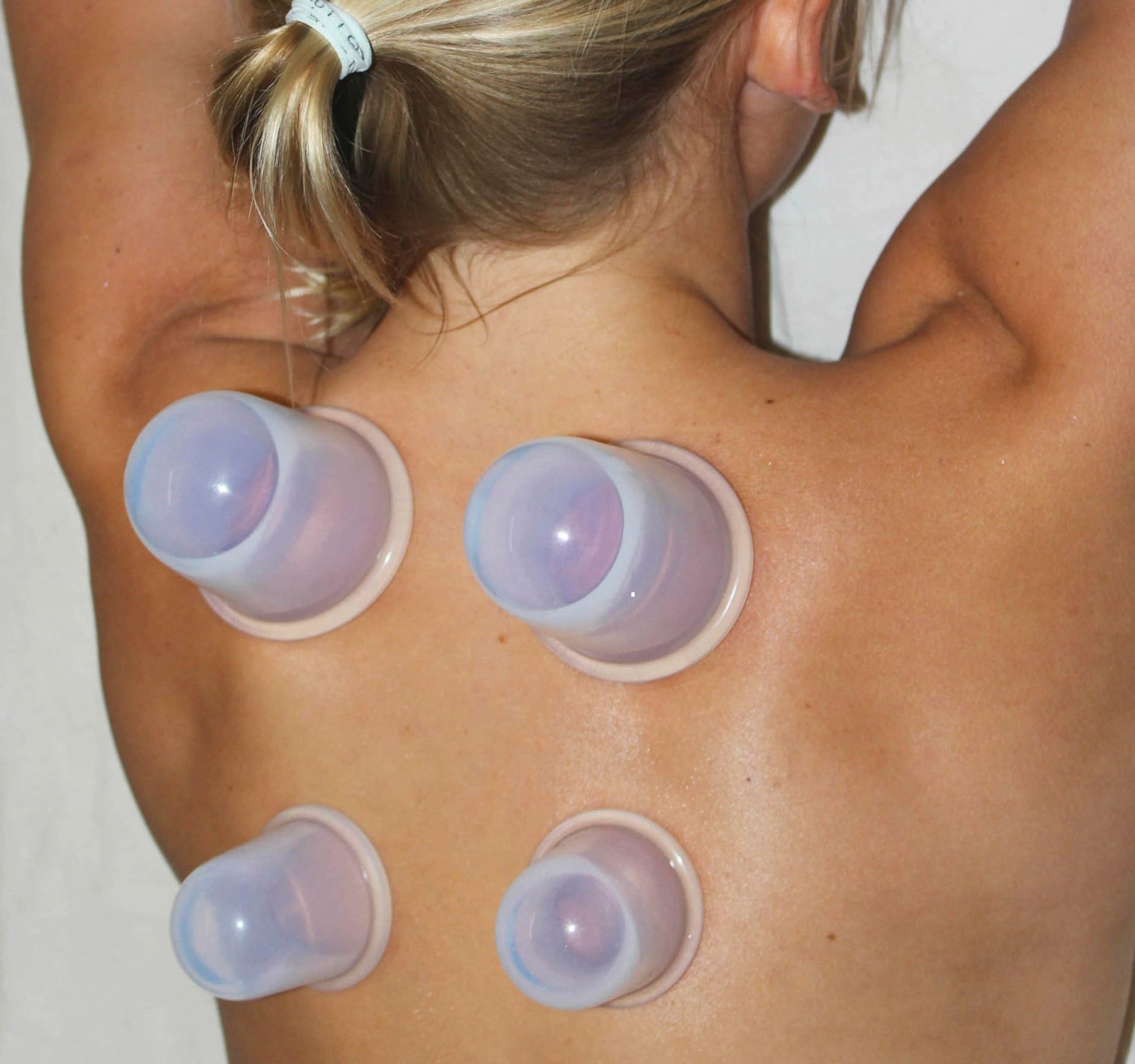 Cupping Kit for Massage Therapy - by DoSensePro, Cupping Set of 6 Professional Silicone Cups DoSensePro uk supplements