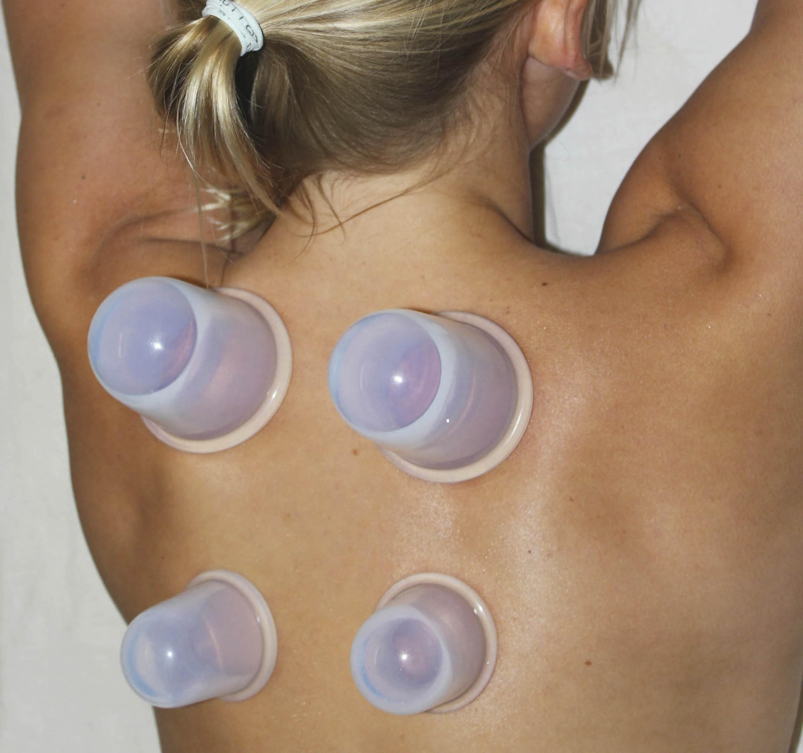 Cupping Kit for Massage Therapy - by DoSensePro, Cupping Set of 6 Professional Silicone Cups DoSensePro uk supplements
