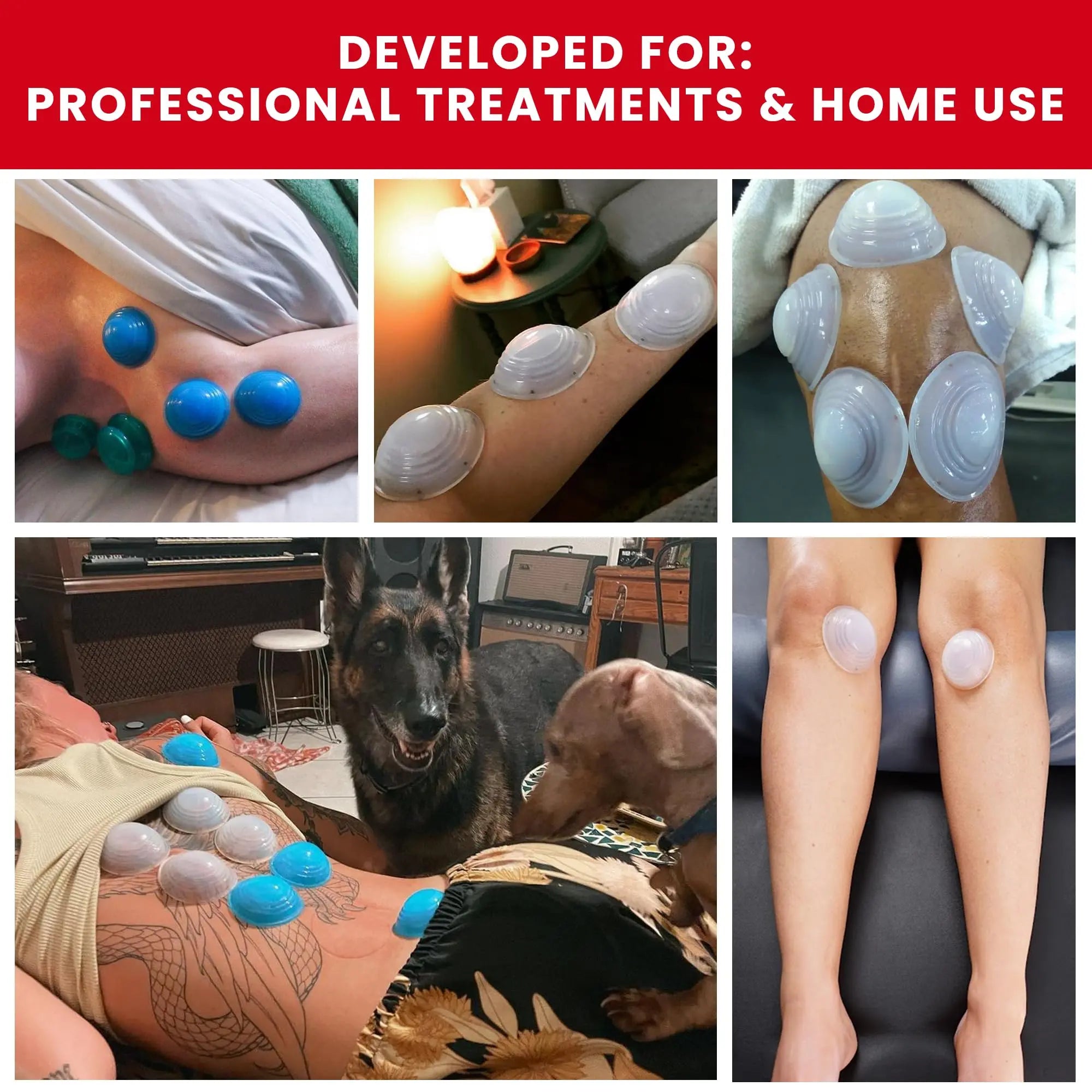 Lure Essentials Cupping Therapy Set 10 Professional Silicone Cupping Cups for Muscle Knots, Joints, Muscles, Arms and Feet Lure Essentials uk supplements