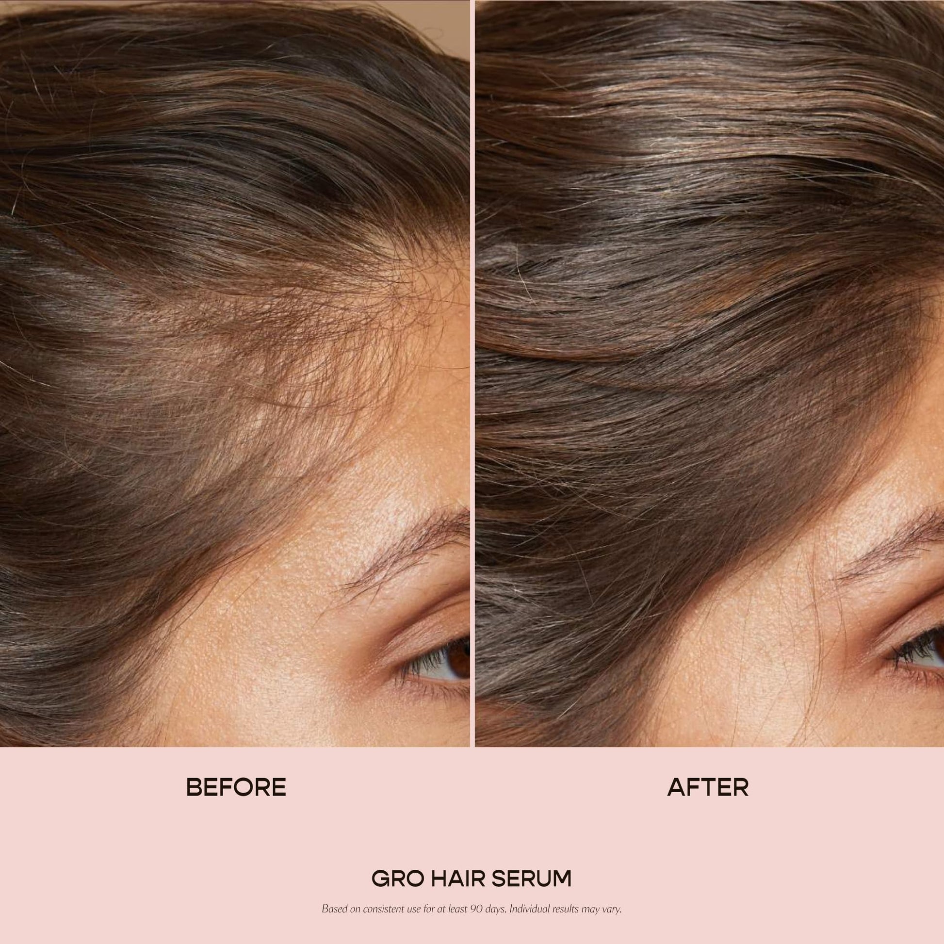 VEGAMOUR GRO Hair Serum for Hair Thinning, Thicker Fuller Looking Hair, Non Oily Tonic, 3 pack, 90 day supply VEGAMOUR uk supplements