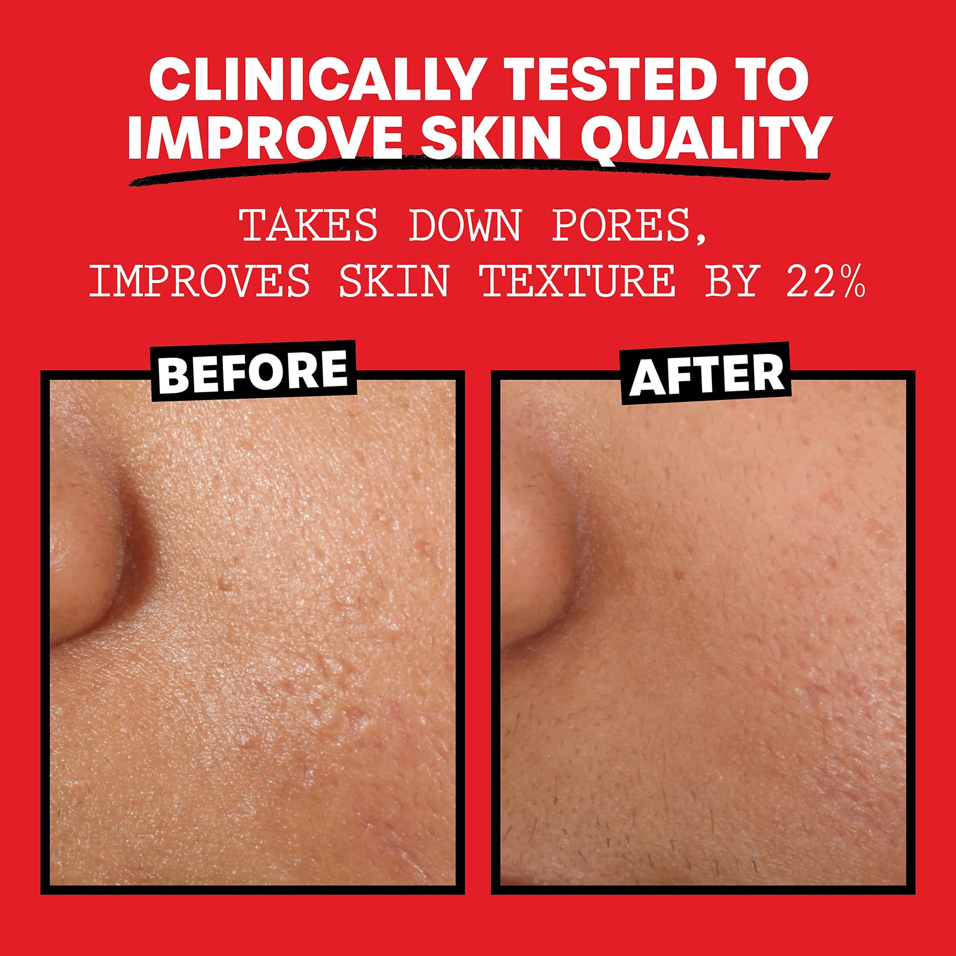 Thayers Alcohol-Free, Hydrating Rose Petal Witch Hazel Facial Toner 12 oz + 3oz THAYERS uk supplements