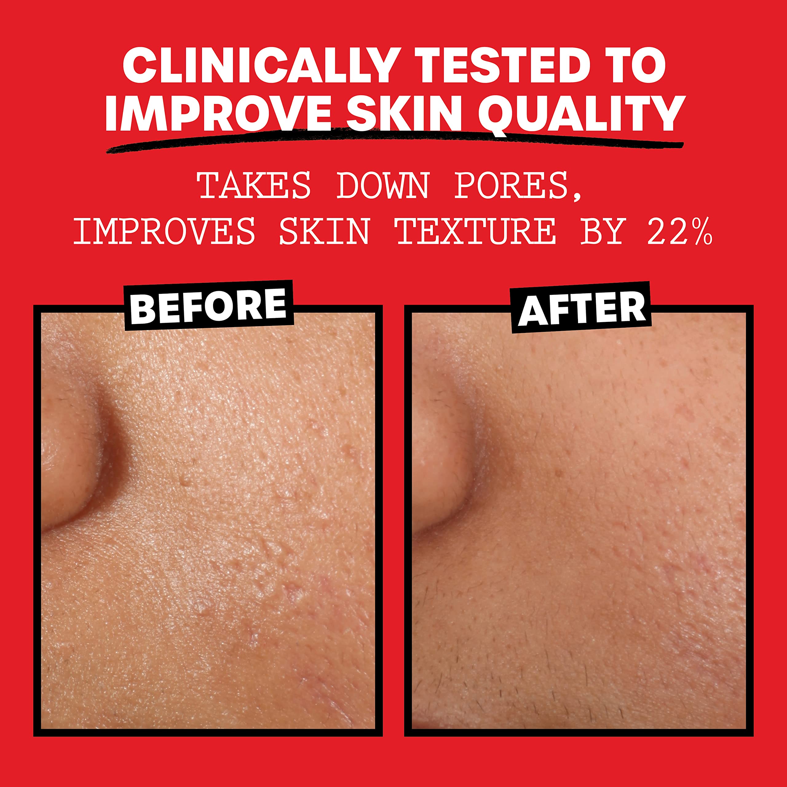 Thayers Alcohol-Free, Hydrating Rose Petal Witch Hazel Facial Toner 12 oz + 3oz THAYERS uk supplements