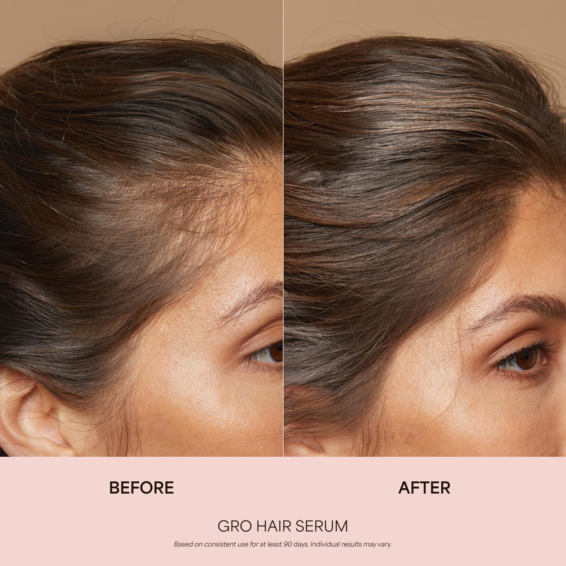VEGAMOUR GRO Healthy Hair Starter Kit | Full Size GRO Serum for Thinning & Shedding plus Travel Size Shampoo and Conditioner with Vegan Keratin to Support Thicker, Fuller Looking Locks | $92 Value VEGAMOUR uk supplements