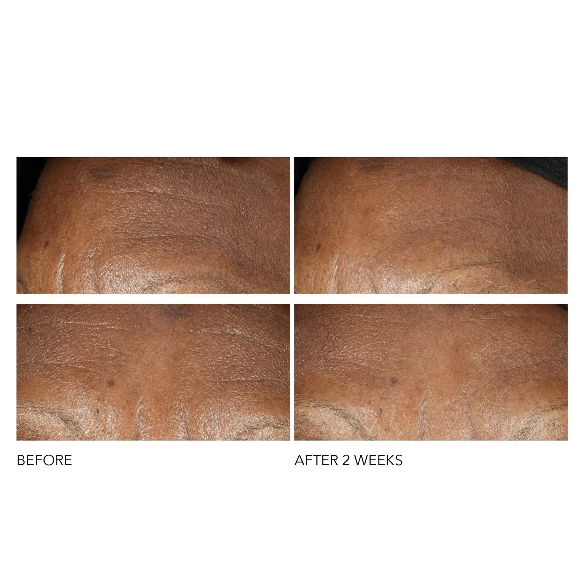 Dr Dennis Gross Advanced Retinol + Ferulic Intense Wrinkle Cream | Intensely Hydrating to Visibly Transform Skin and Repair the Moisture Barrier | 2 oz Dr Dennis Gross uk supplements