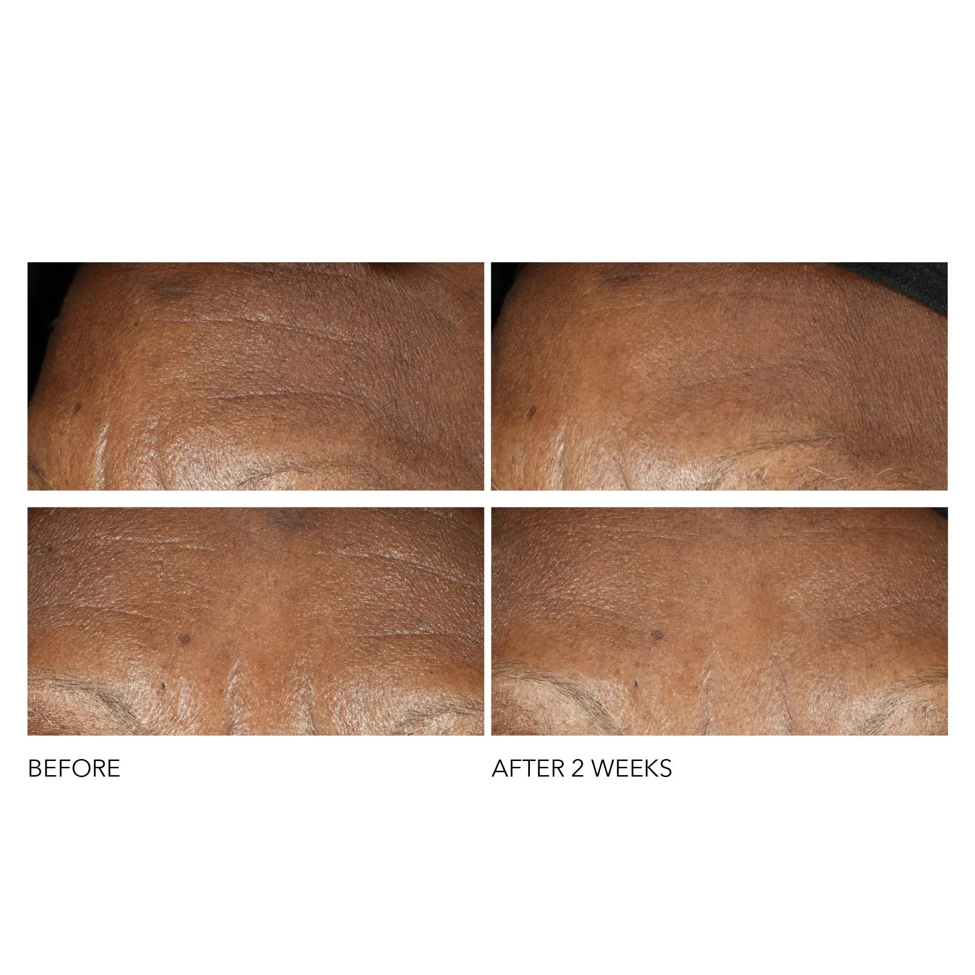 Dr Dennis Gross Advanced Retinol + Ferulic Intense Wrinkle Cream | Intensely Hydrating to Visibly Transform Skin and Repair the Moisture Barrier | 2 oz Dr Dennis Gross uk supplements