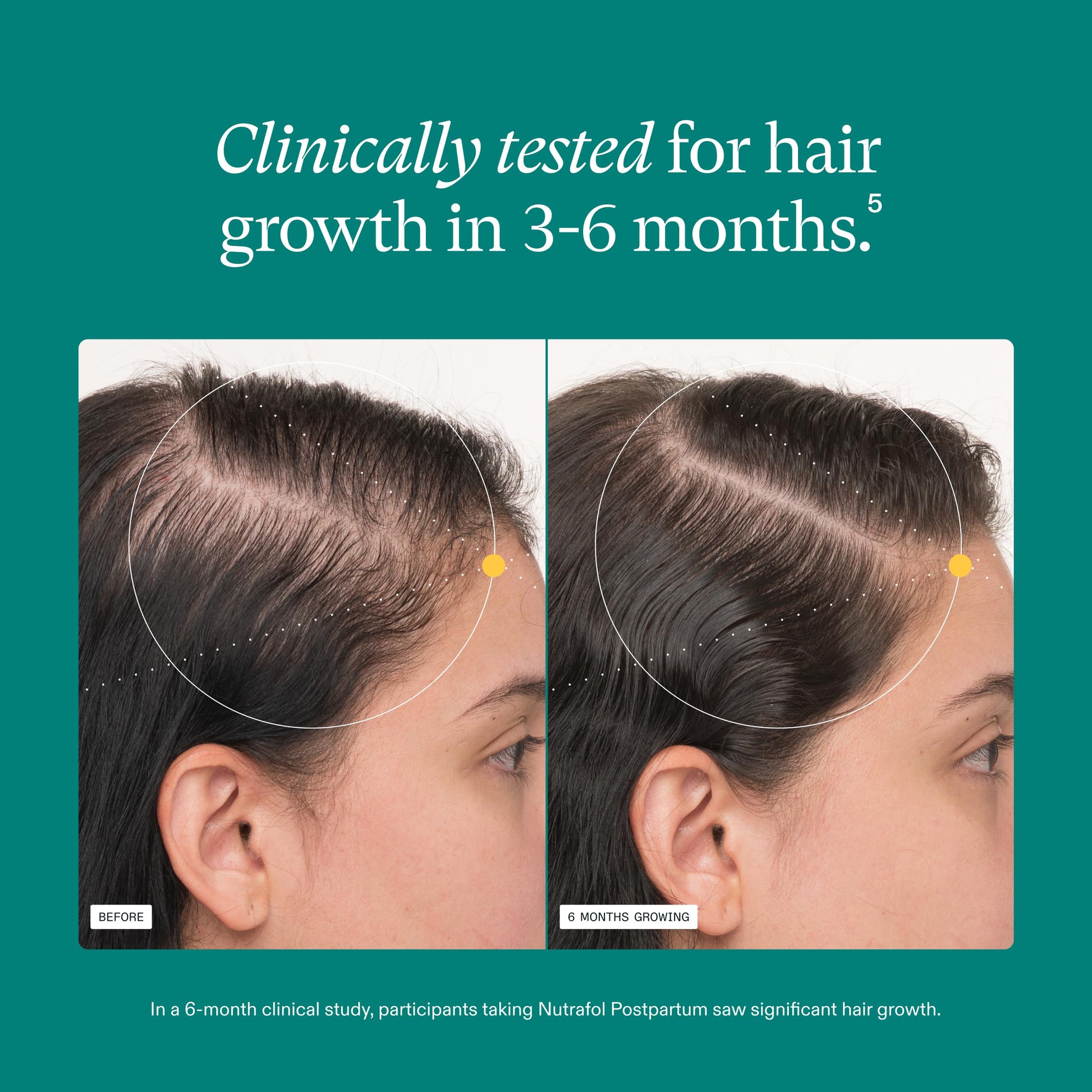 Nutrafol Postpartum Hair Growth Supplements, Clinically Tested for Visibly Thicker Hair and Less Shedding, Breastfeeding-friendly - 1 Month Supply Nutrafol uk supplements