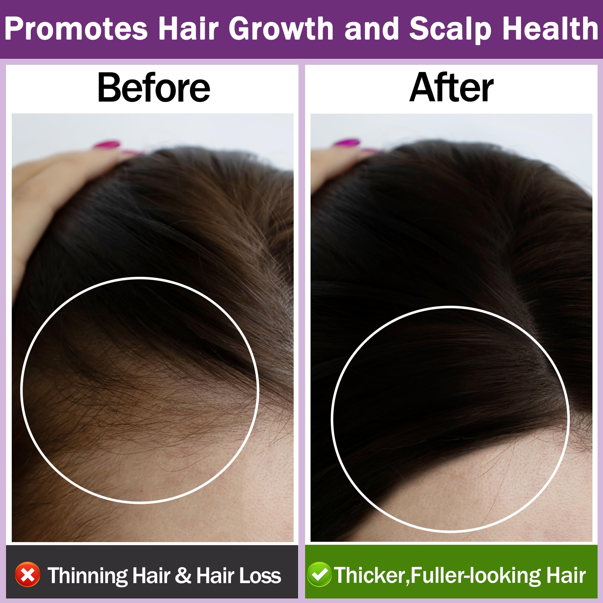 Rosemary Oil for Hair Growth,100% Pure Undiluted Light-Weight Non-Greasy Rosemary Essential Oil GIFBEA uk supplements