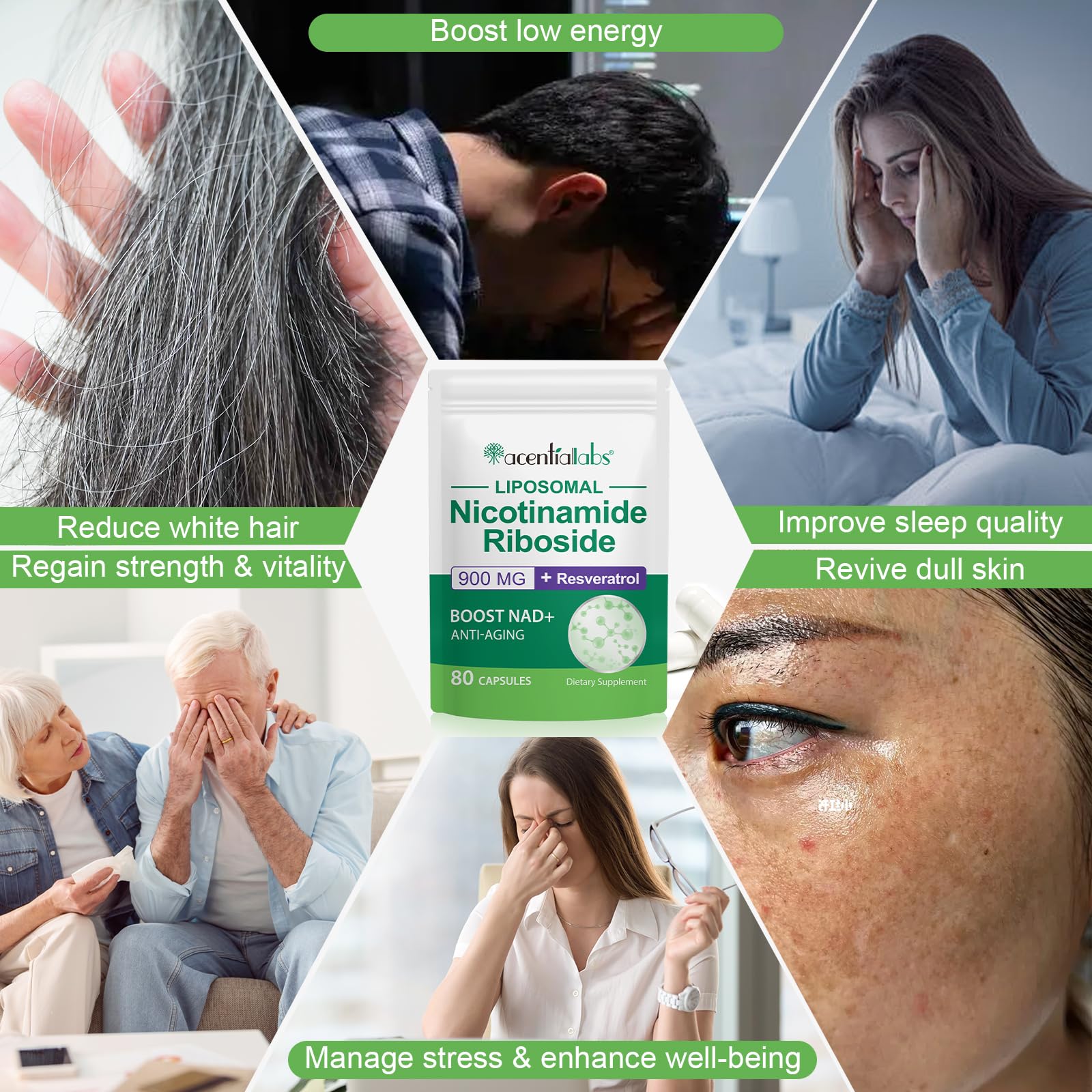 XINSZLIN NAD Supplement, NAD+ Nicotinamide Riboside Resveratrol 900mg, Dietary Supplement for Healthy Cellular Function, NAD+ Fuels Cellular Defense and Cctivates Anti-Aging Genes 80 Capsules XINSZLIN uk supplements