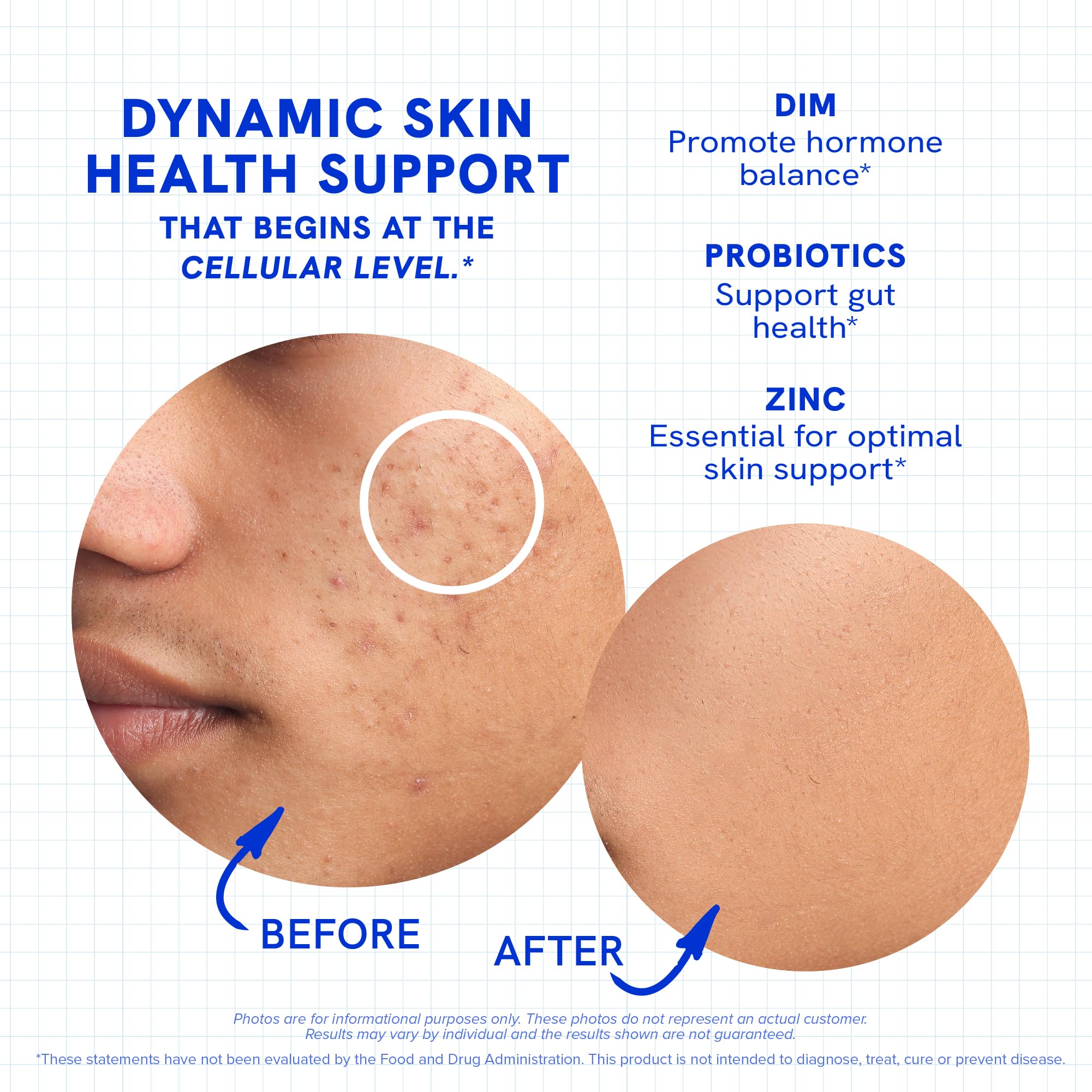 Clear Skin Supplement with Zinc, DIM & Probiotics | 3-in-1 Balance, Glow & Health Skin Support | Triple Action Hyaluronic Acid, Niaciminide & Vitamins for Hormone, Complexion & Gut Support | 180 Ct SMNutrition uk supplements